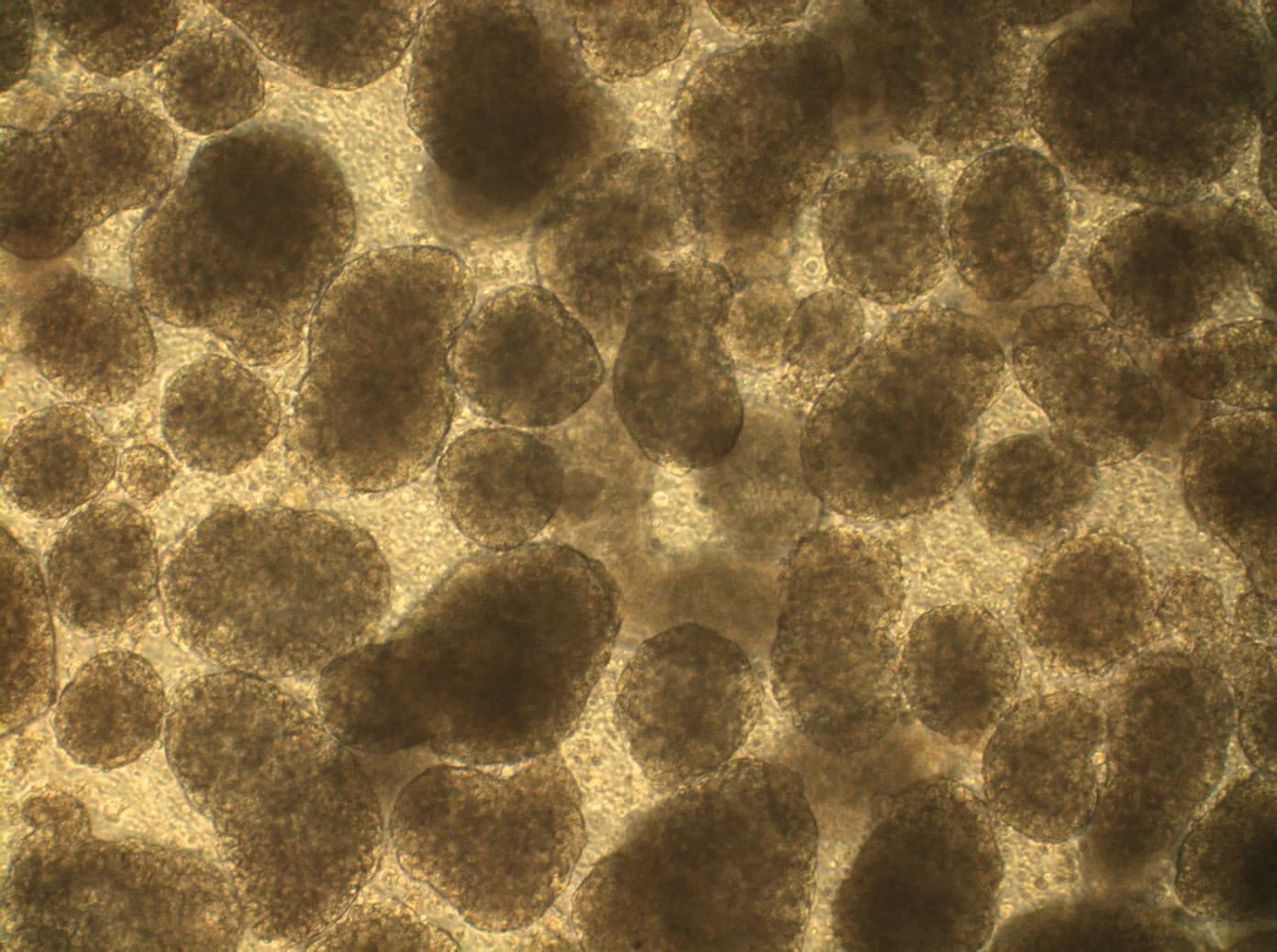 When lab-scale biology meets manufacturing reality: where most scale-up goes wrong
