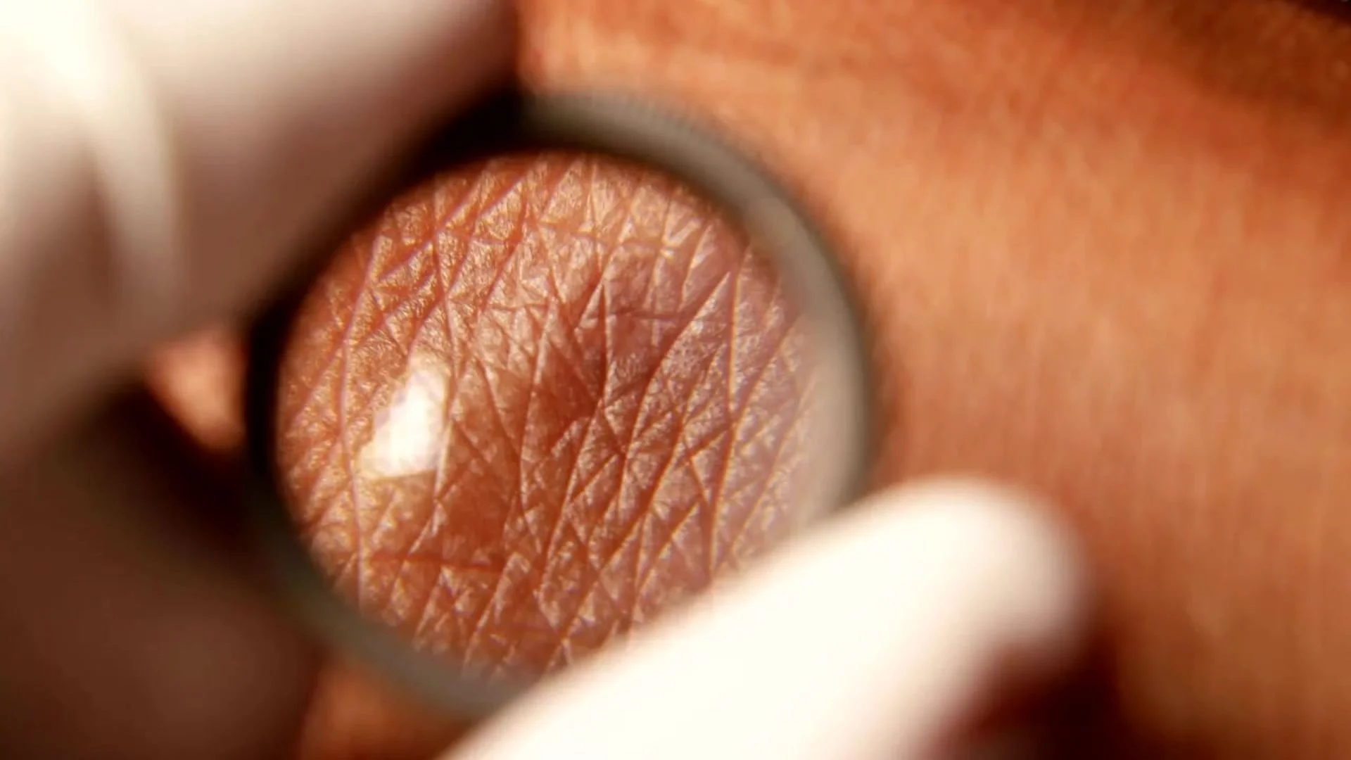 Comprendre la peau : structure et fonctionnement