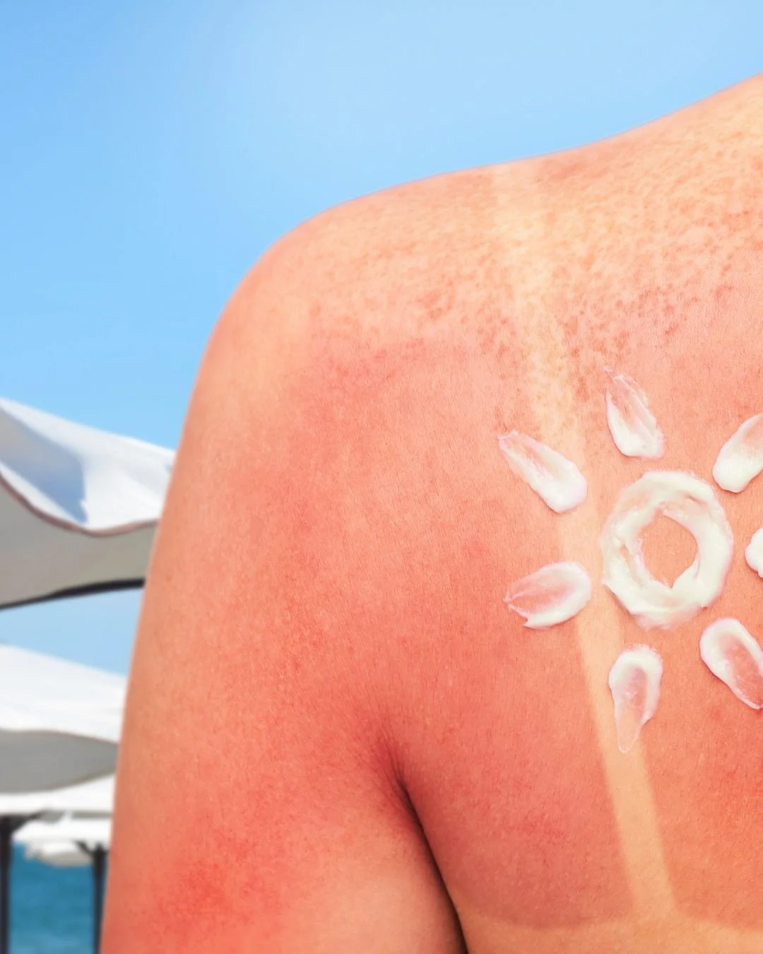 Préparer sa peau au soleil : un geste essentiel pour sa santé et sa beauté
