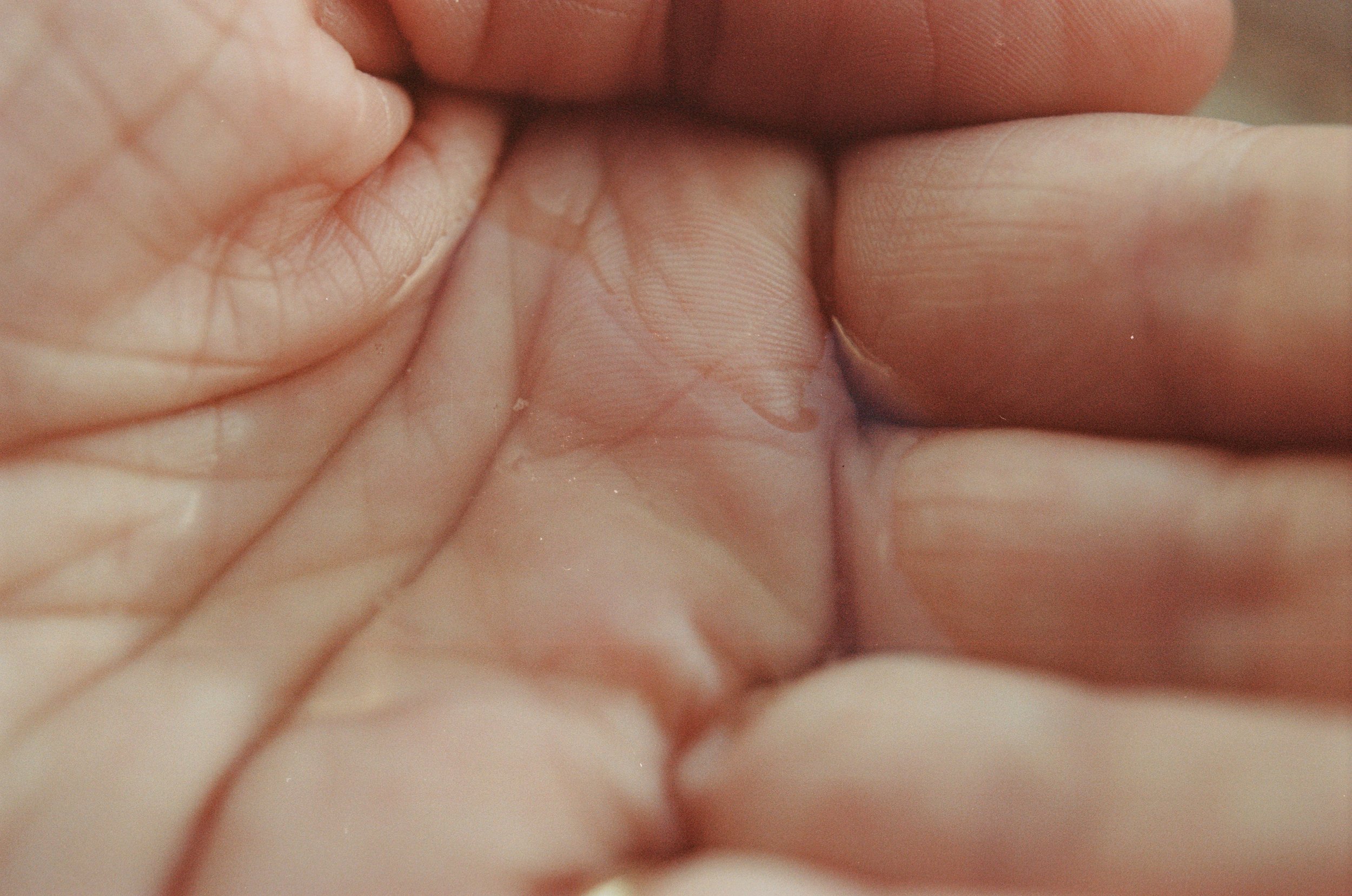 An image of Greenspacing.