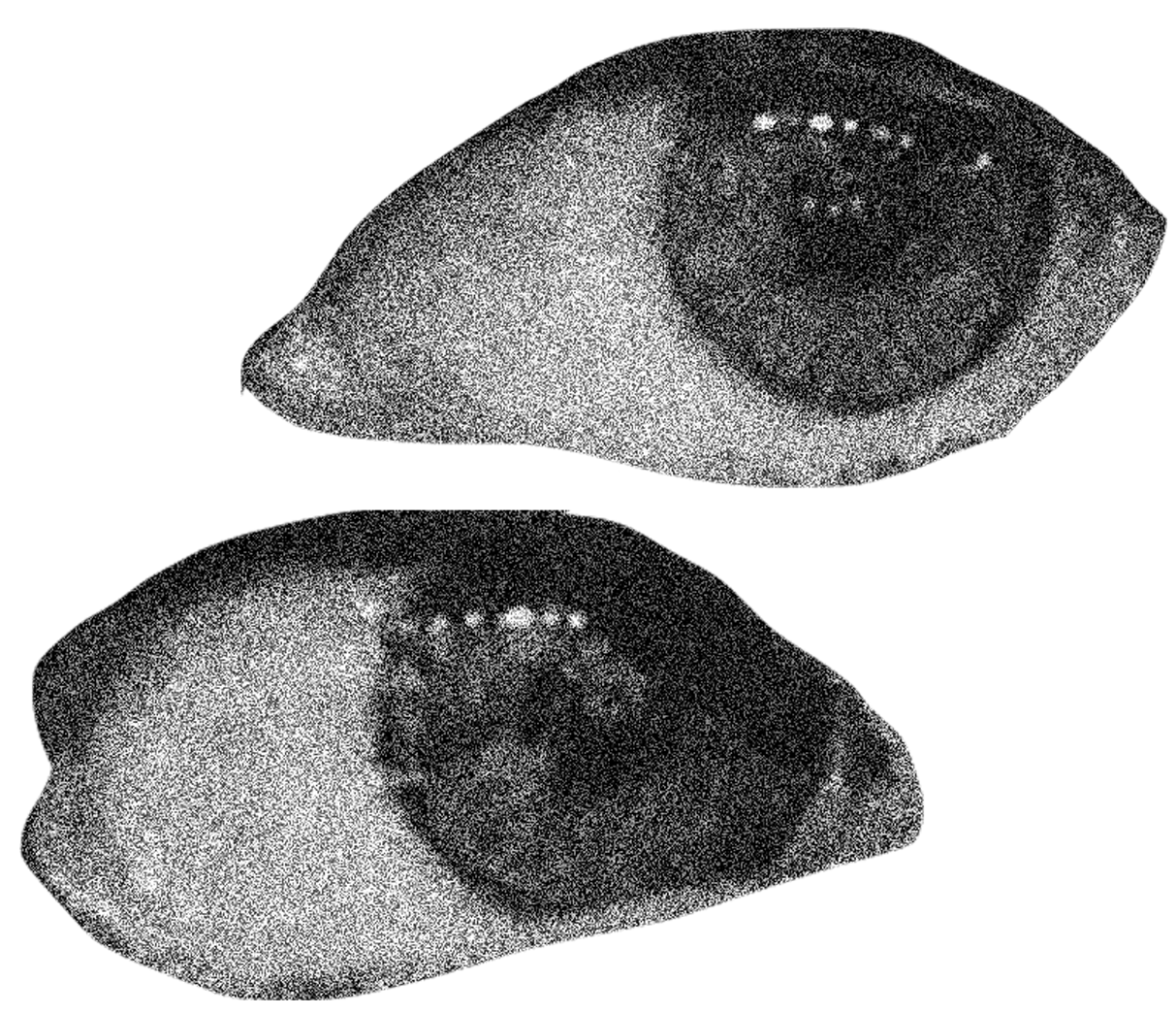 Black and white, grainy close-up of a human eye, viewed from the side, showing the iris, pupil, and eyelashes.