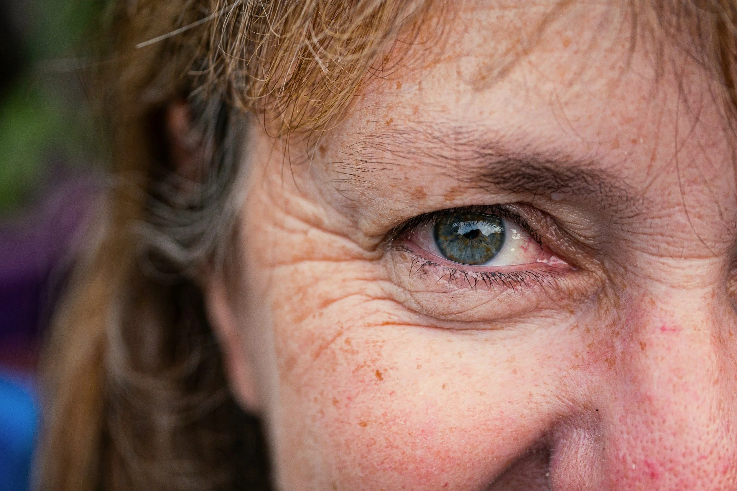 Antiaging Treatments West Cork