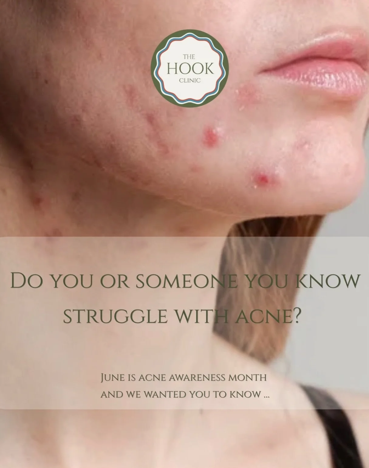 Acne Awareness Month reminds us of something important: acne is never &ldquo;just acne.&rdquo;

Whether you&rsquo;re 15 or 50, acne can affect confidence, self-esteem, comfort, and how you feel in your own skin. And while there is no shortage of advi