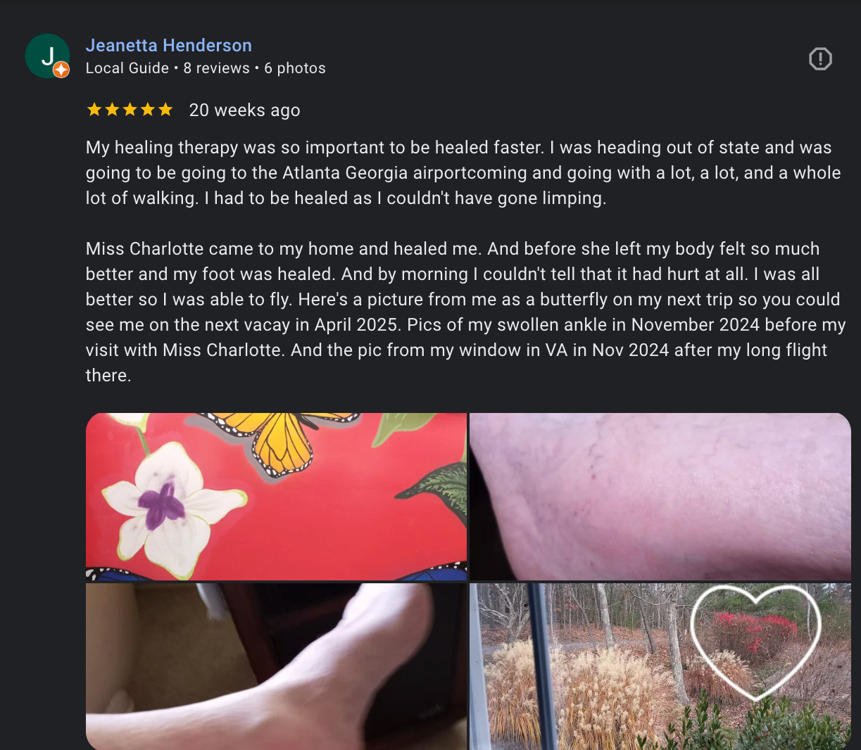 Collage of four photos: a butterfly on a flower with a pink background, a close-up of skin with a pinkish hue, an arm resting on a dark piece of furniture, and a landscape of trees and plants with a white heart outline over the scene.