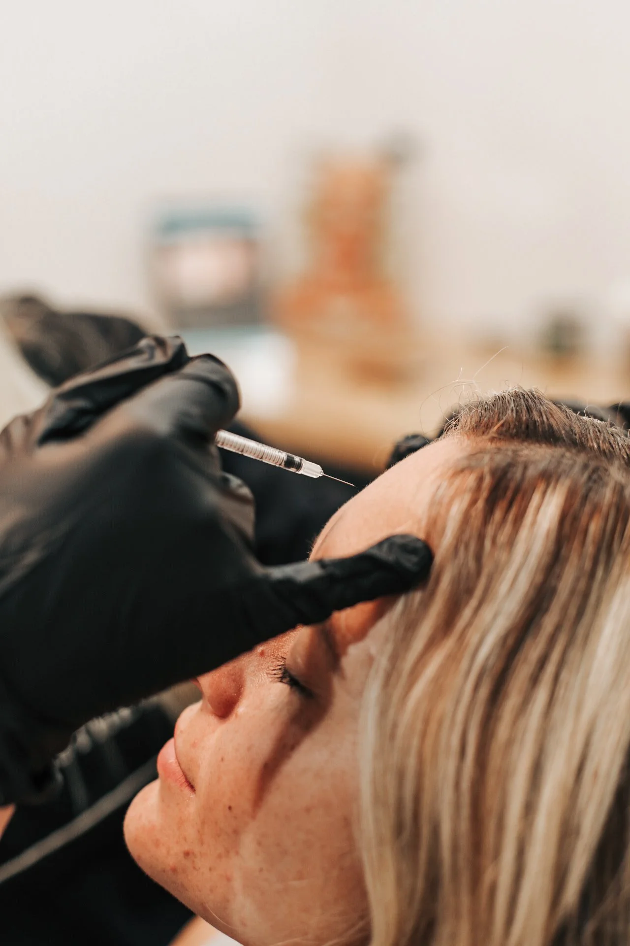 lip and dermal filler