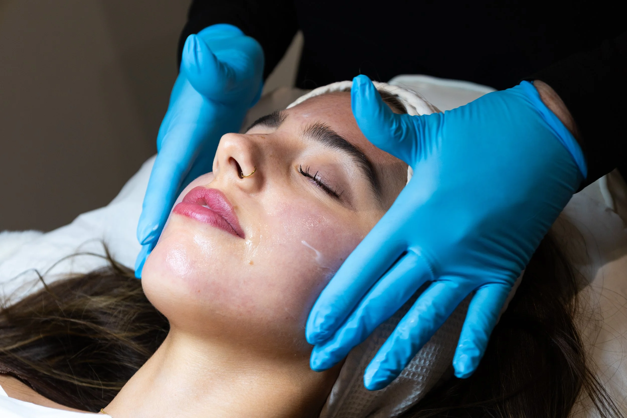 Corrective Facials Explained