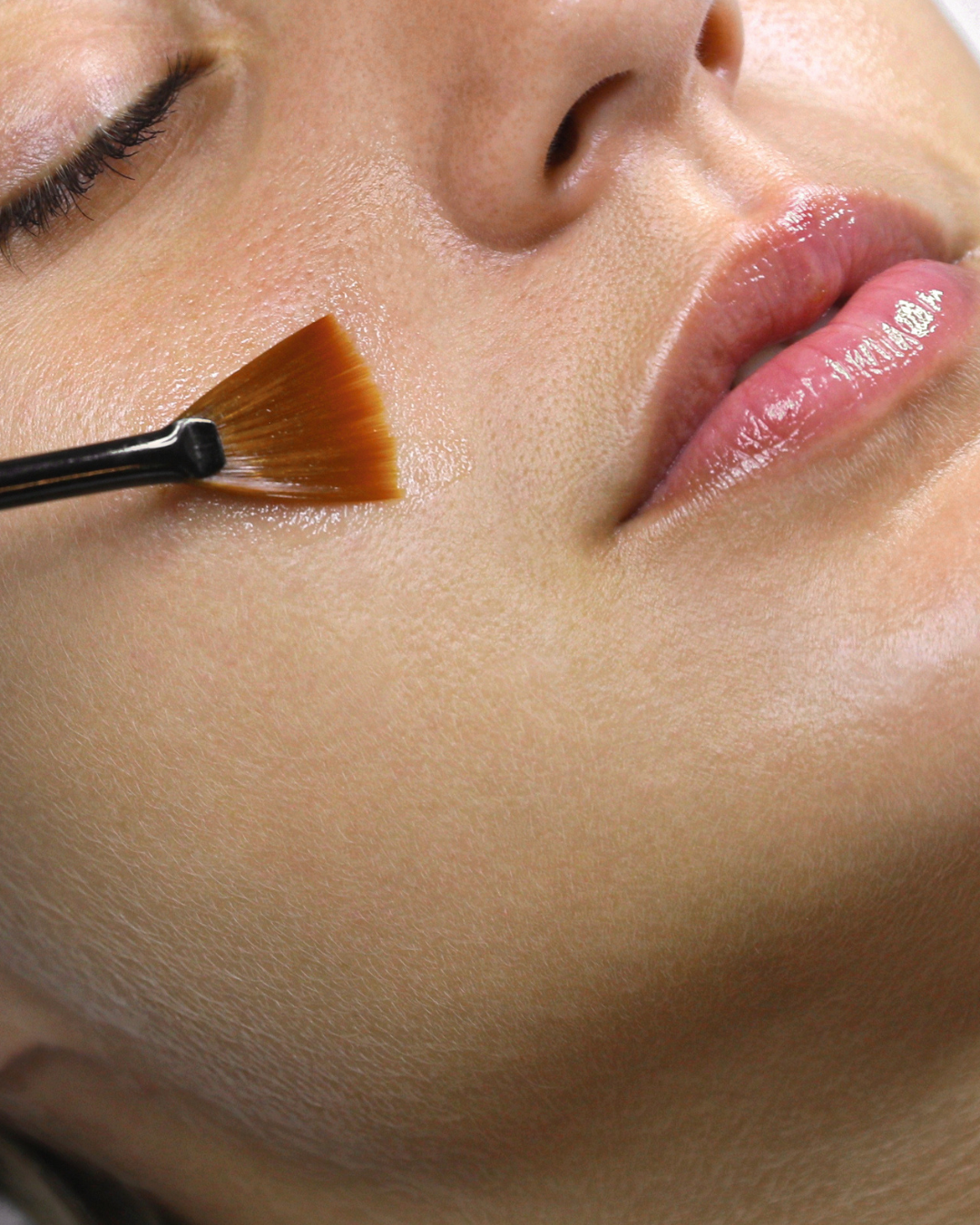 Finding a Medical Esthetician in Surrey, BC