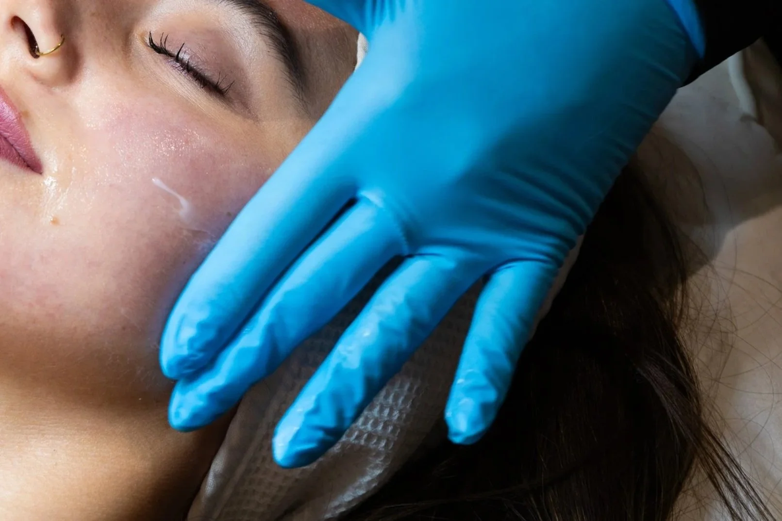 Esthetician vs. Dermatologist vs. Med Spa: Who Actually Treats What