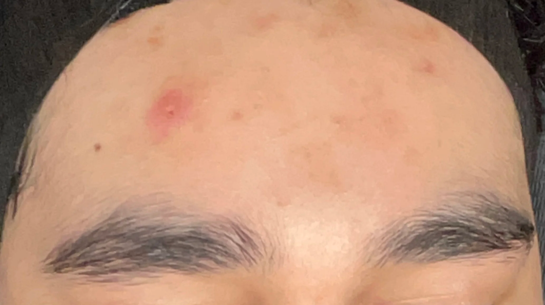 Realistic Timelines: How Long Corrective Skincare Actually Takes