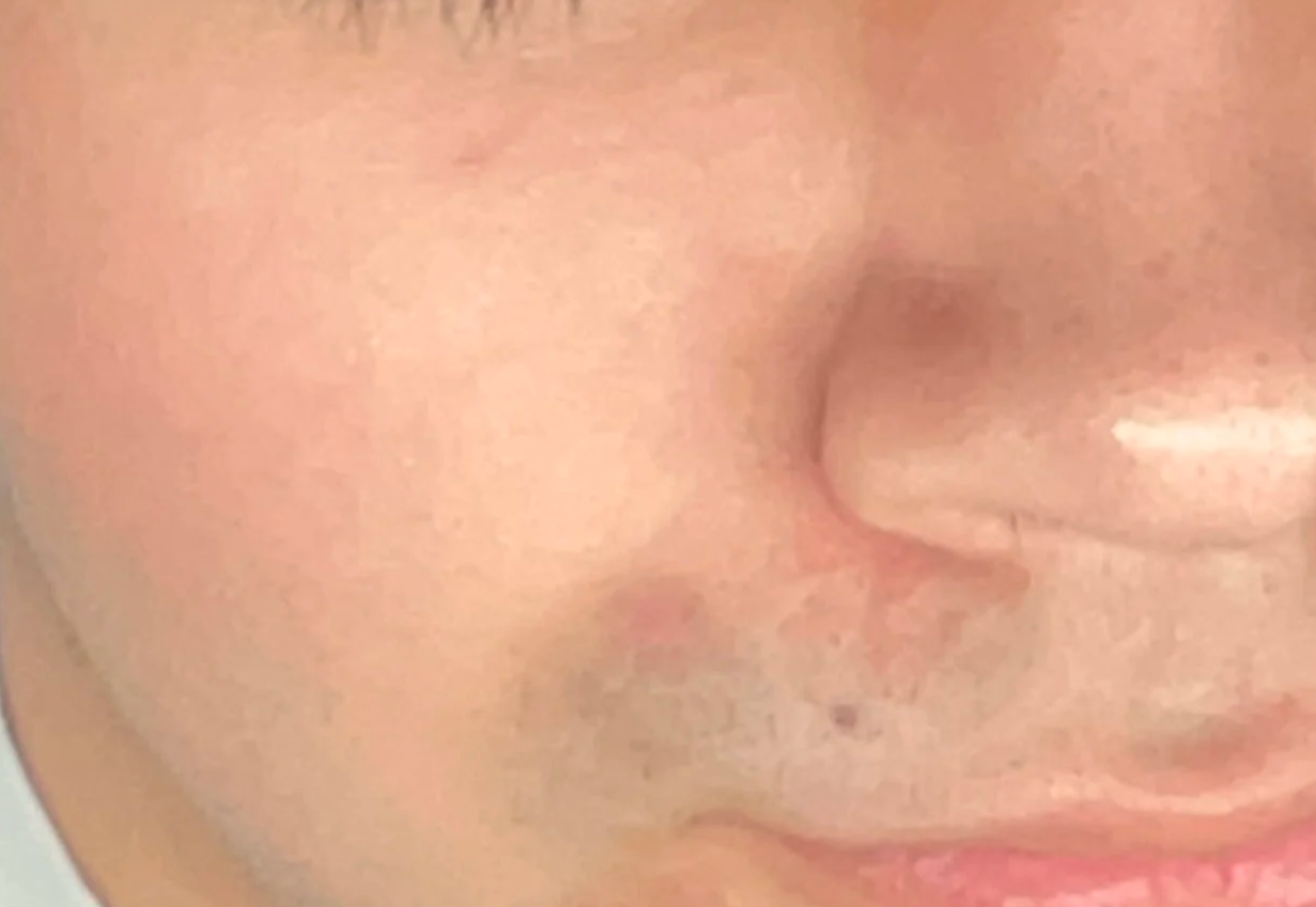 Rosacea and Reactive Skin: What Corrective Care Looks Like When Your Skin Fights Back