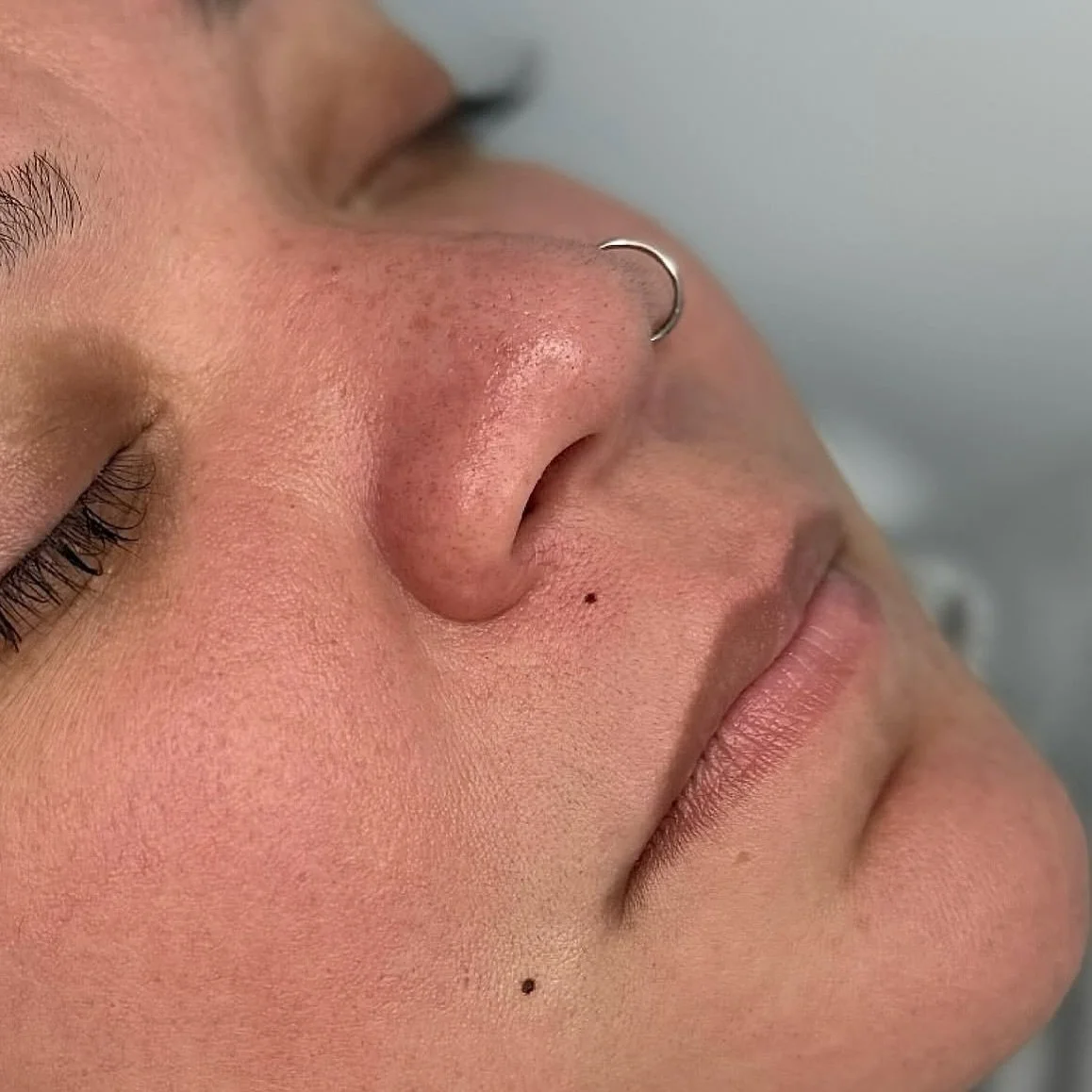 ✨ GRAINS DE BEAUT&Eacute; &ndash; JOUR J vs CICATRISATION ✨

Parce que parfois&hellip; ce sont les petits d&eacute;tails qui changent tout.

Sur la premi&egrave;re photo 👉 juste apr&egrave;s la s&eacute;ance
Sur la seconde 👉 apr&egrave;s cicatrisat