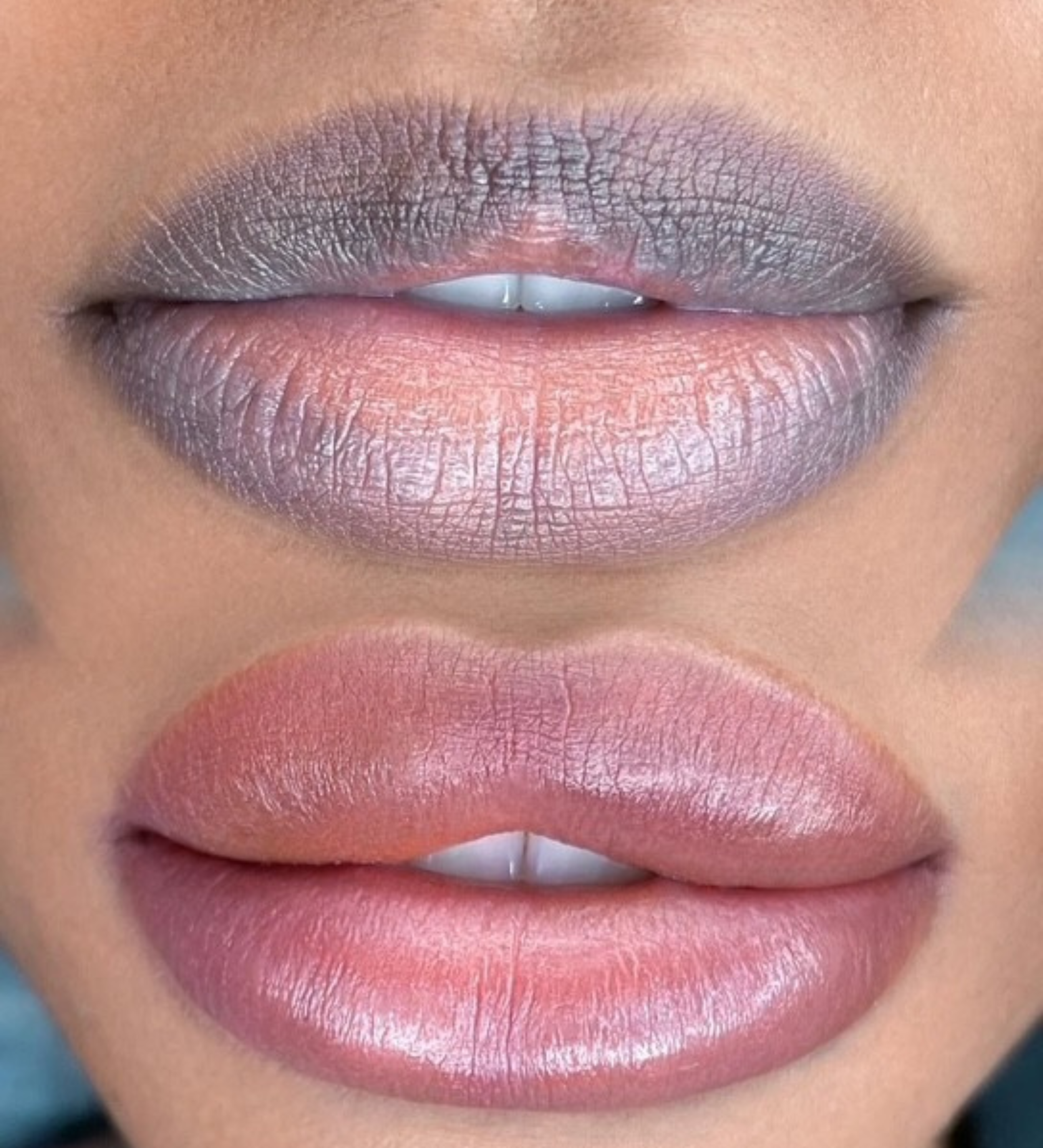 Neutralisation des lèvres foncées par maquillage permanent technique dark lips chez Onyx Studio