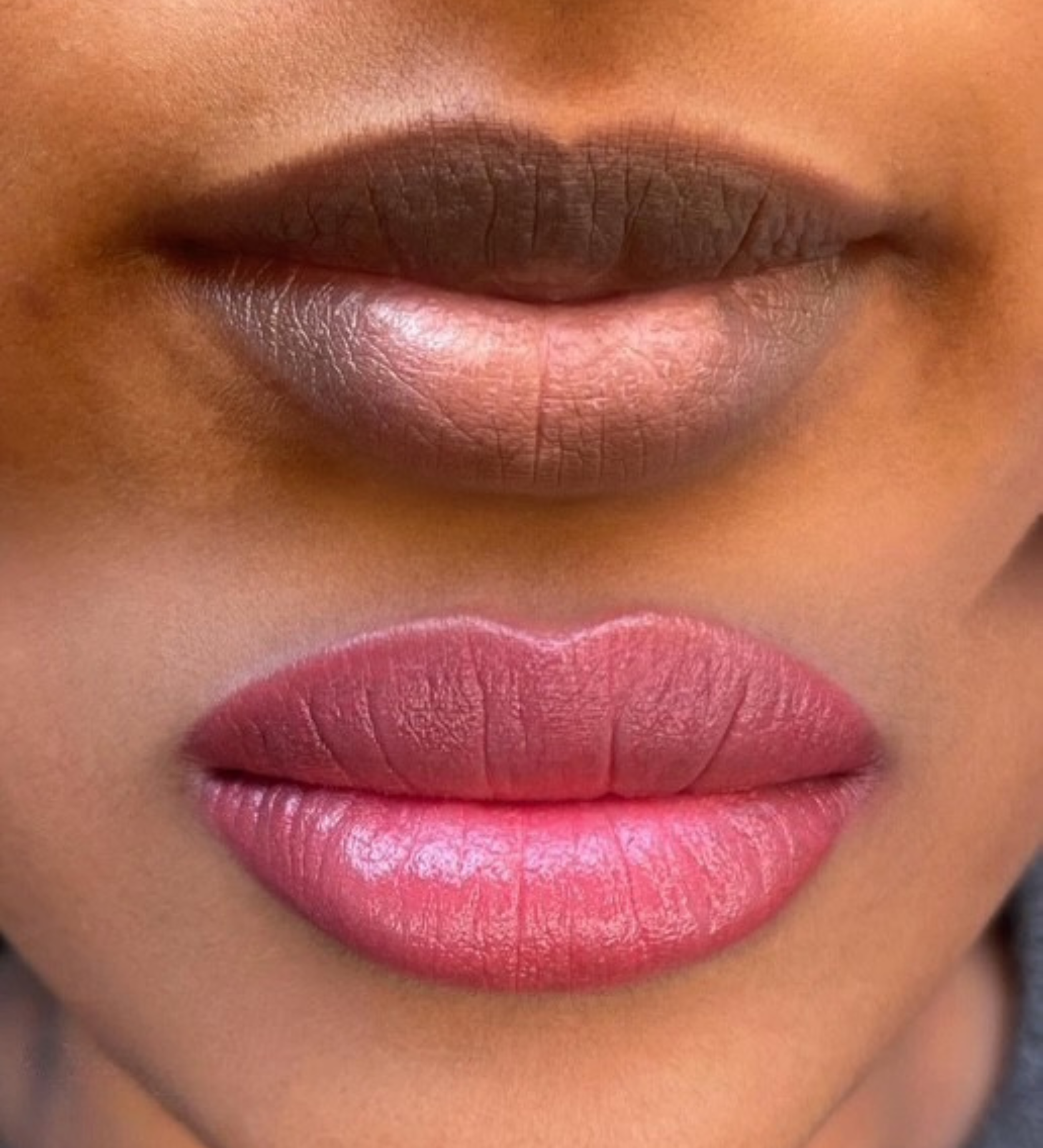 Correction Dark Lips à Marseille, neutralisation des lèvres foncées par dermopigmentation experte chez ONYX Studio.