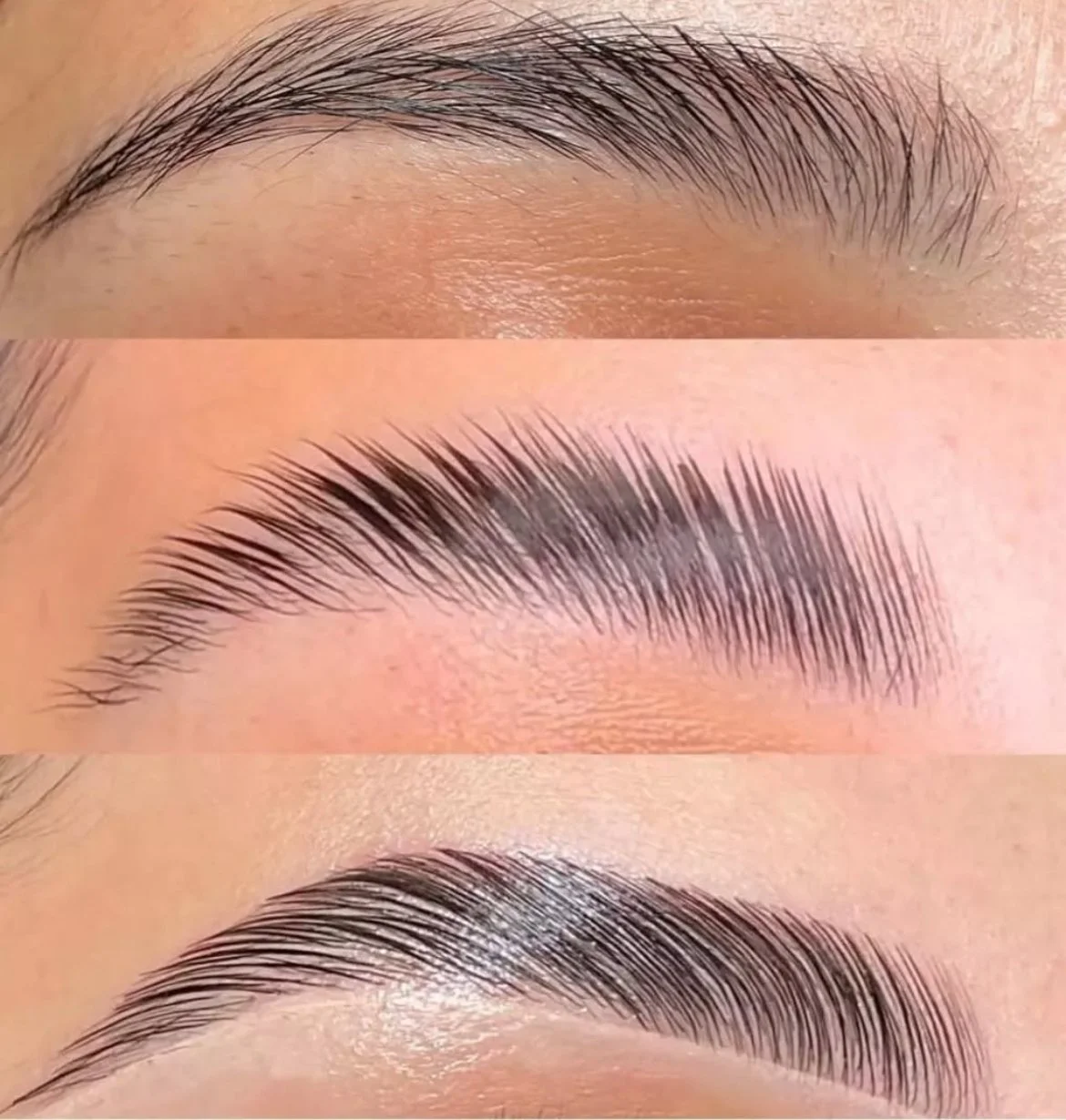 Restructuration des sourcils par lamination technique brow lift