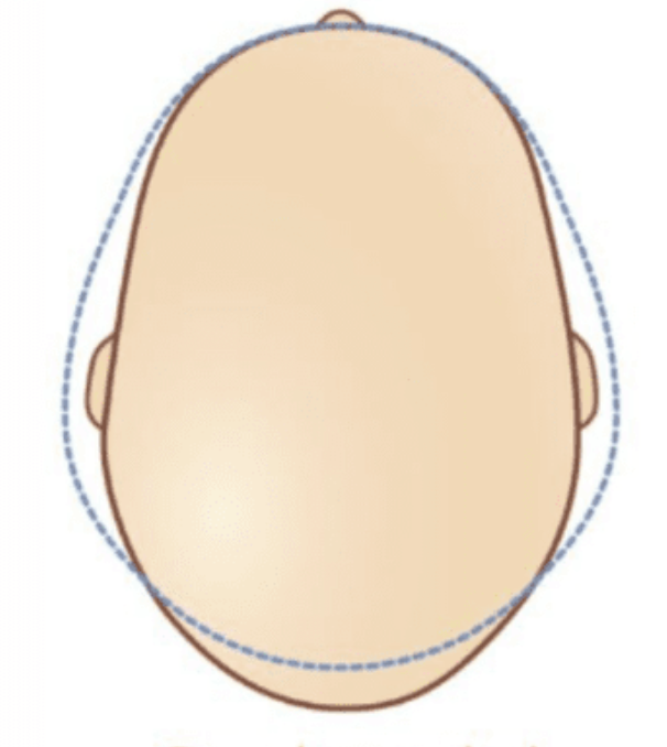 A diagram of a human head viewed from the front, showing the scalp.