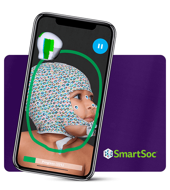 A child in a colorful, patterned cap using a smartphone with a brain activity monitoring app from SmartSoc, showing progress at 20%.