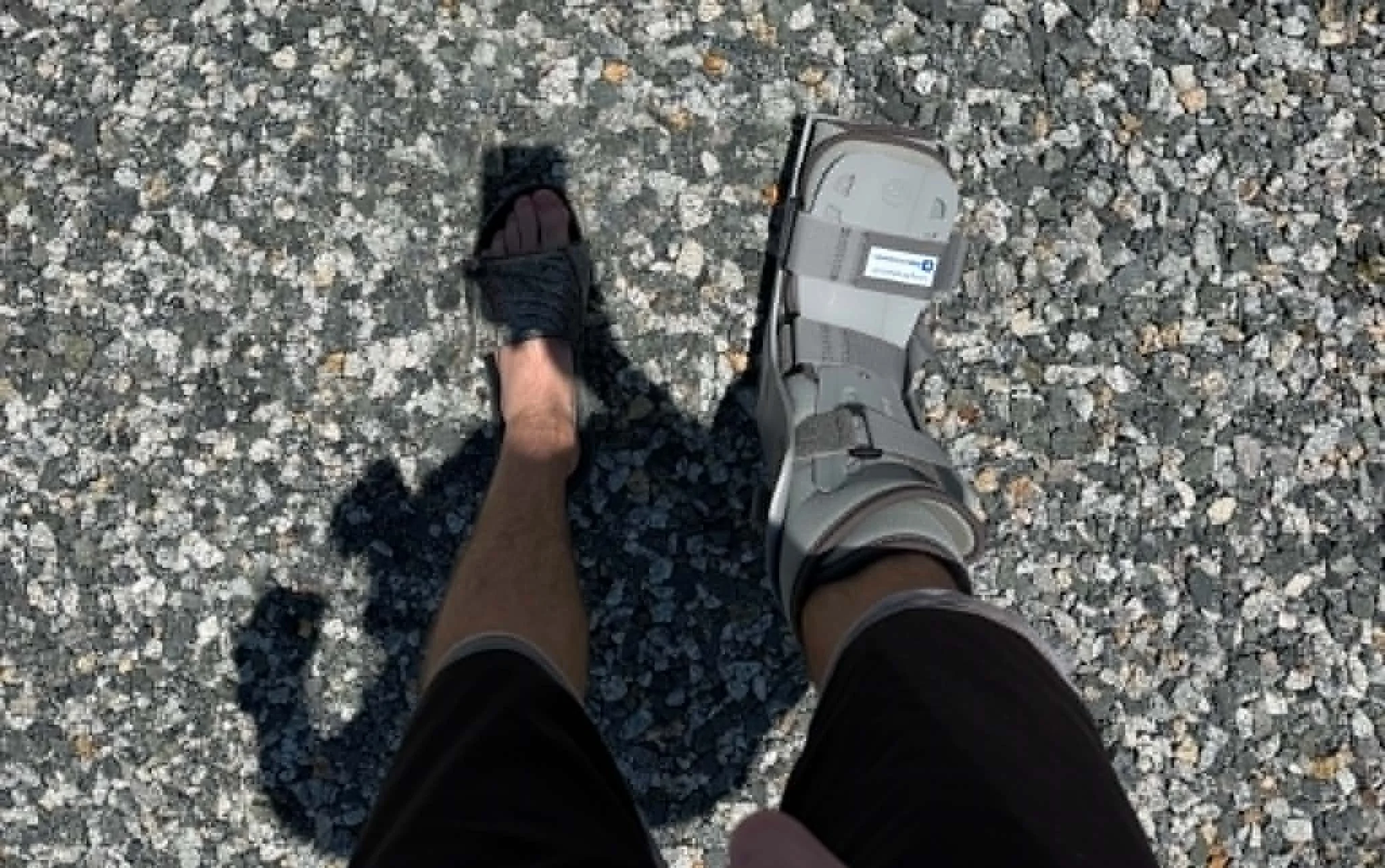 Injury Persist - Grindstone 100 Miler Prep - Week 7
