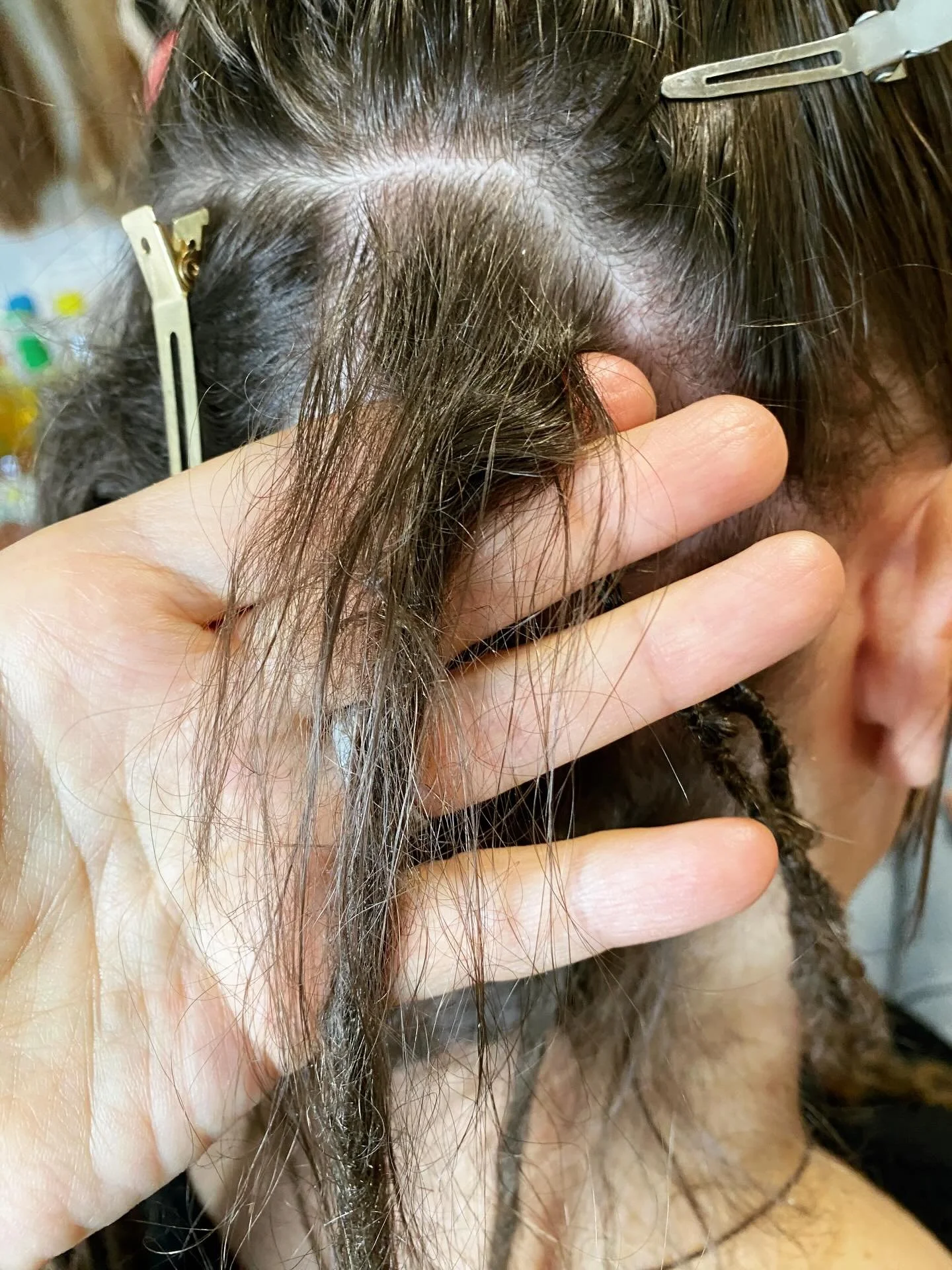 Hier sieht man ganz besonders warum es wichtig ist die Dreadlocks von Zeit zu Zeit zu pflegen. 
Das sind Haare, die teilweise aus dem Dread rausgerutscht sind und teilweise neu gewachsen, den wir verlieren jeden Tag hunderte von Haaren, die dann neu 