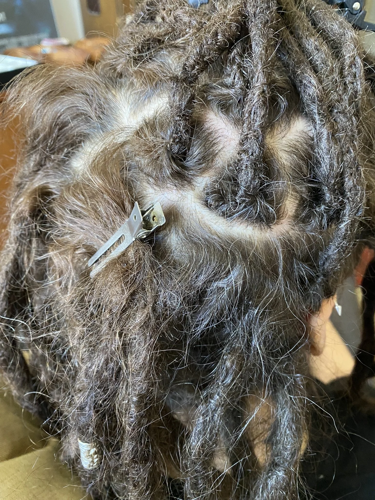 Haarwuchs mit dreadlocks und Haarclip.