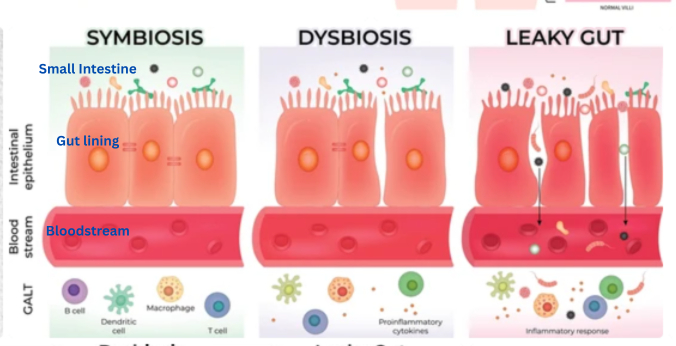 Leaky Gut Explained: Understanding the Gut Lining — Healthspan Wellness ...