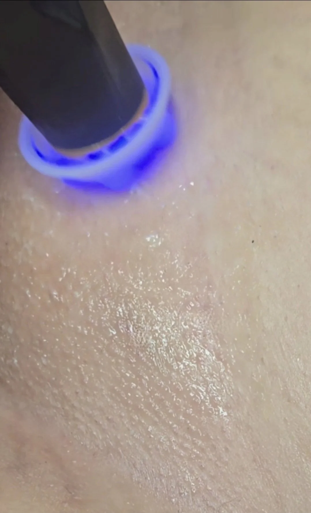 The Luxe Skin Reset + Brazilian Wax