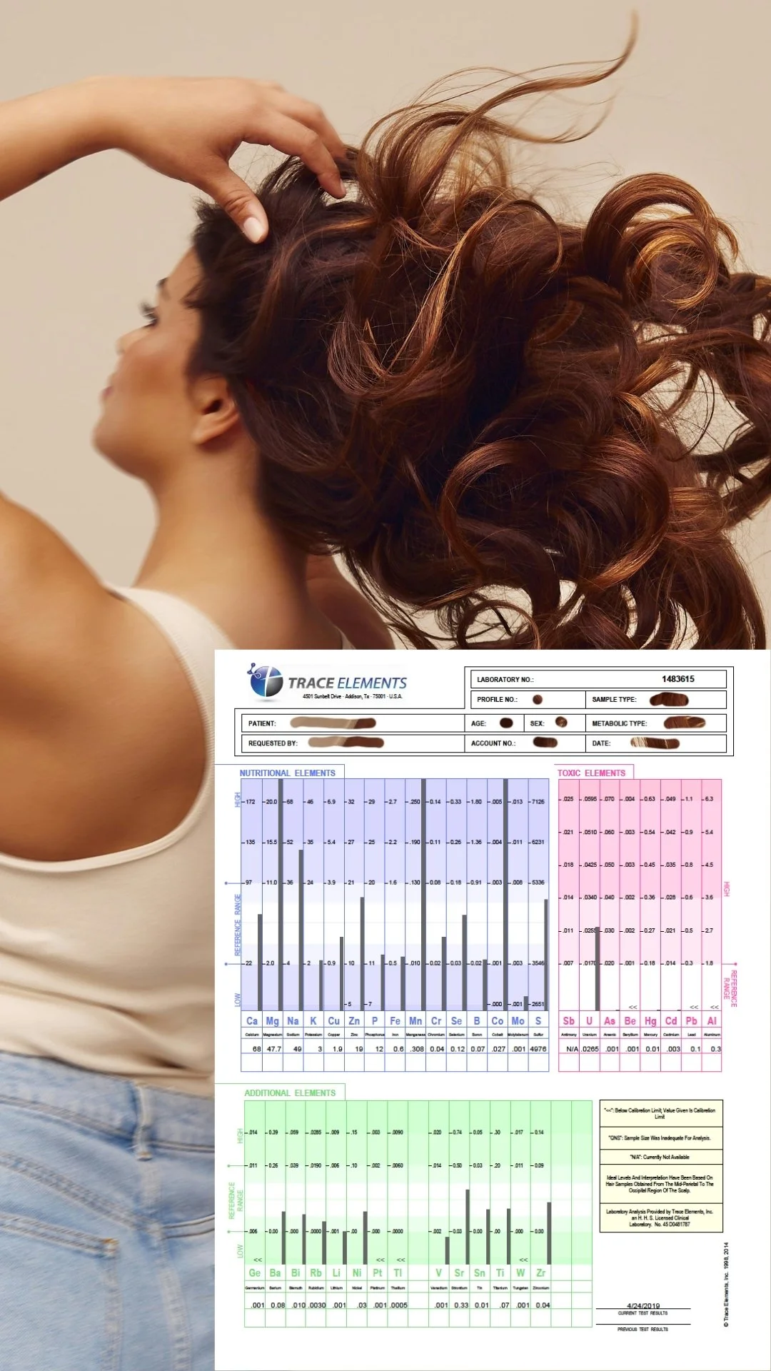 HTMA (Hair Trace Mineral Analysis)