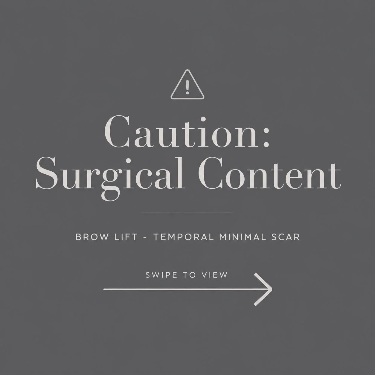 Surgical Video: Temporal Incision Brow Lift &mdash; A minimally invasive approach to brow elevation through a discreet temporal incision, designed to provide subtle lateral eyebrow and crows feet elevation and rejuvenation while minimizing visible sc