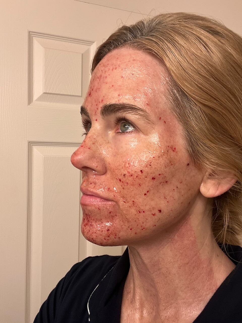 2 Weeks Out — Beautiful Result