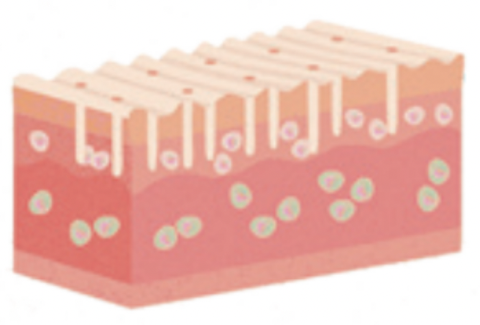 Diagram of human skin layers showing epidermis, dermis, and subcutaneous tissue with hair follicles and blood vessels.