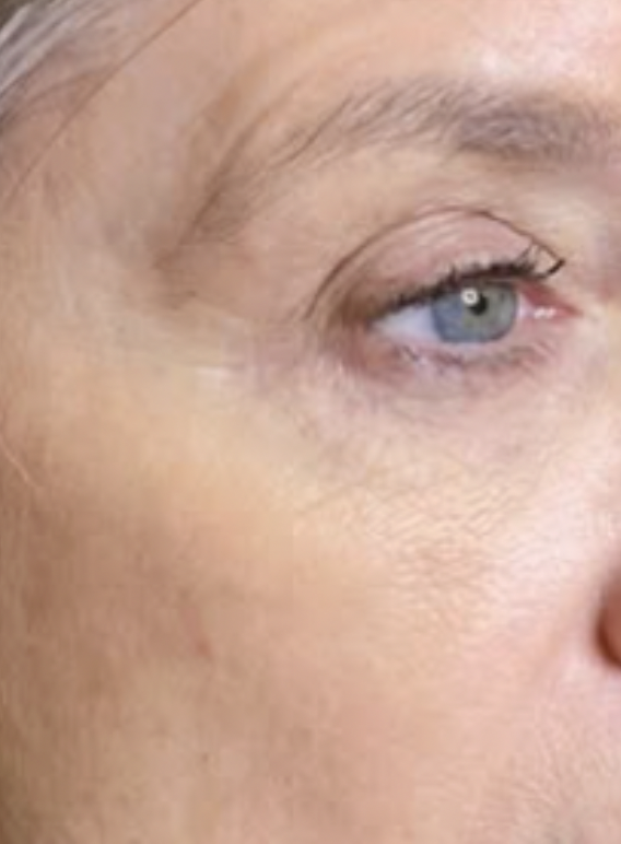 Close-up of a person's face focusing on the eye and cheek, showing skin texture and eye makeup.