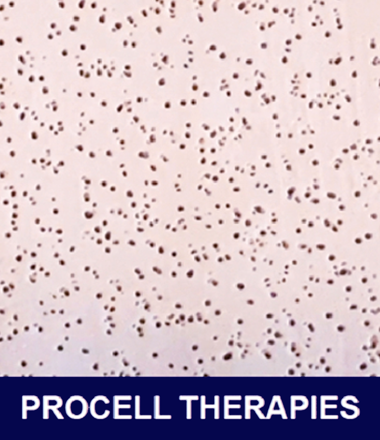 A close-up image of a white surface with many small, dark spots scattered across it, and a dark blue banner at the bottom with the white text 'PROCELL THERAPIES'.