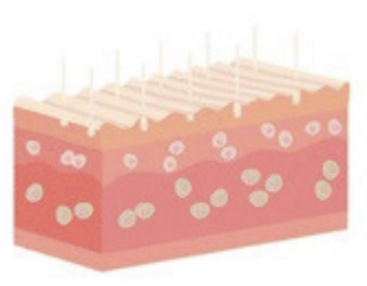 Diagram of human skin layers showing hair follicles, blood vessels, and skin tissue.