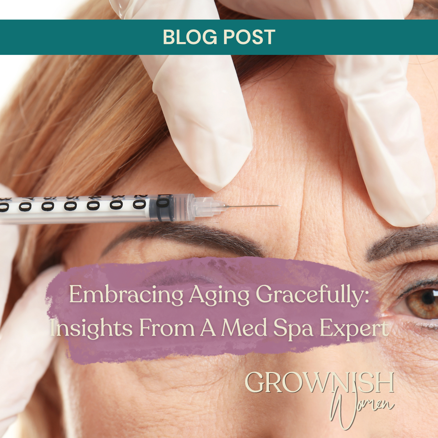Embracing Aging Gracefully: Insights From A Med Spa Expert