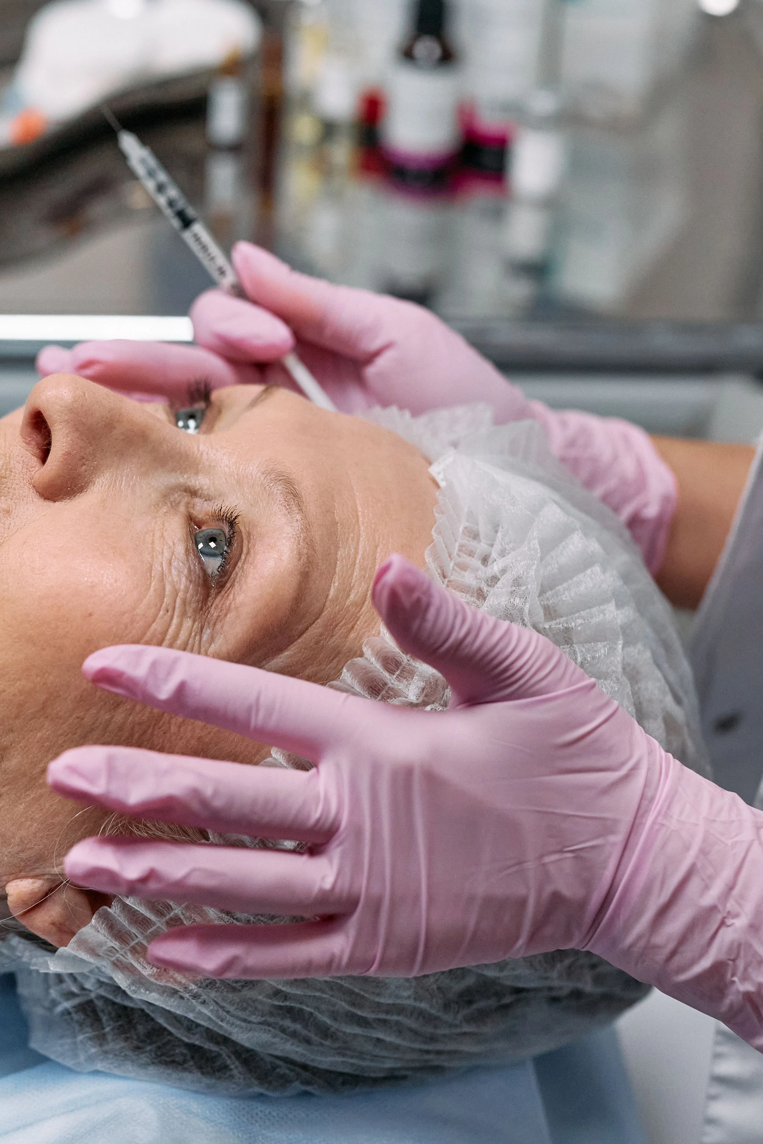 Botox in Mississauga: What to Expect, How It Works, and Why It's Worth It