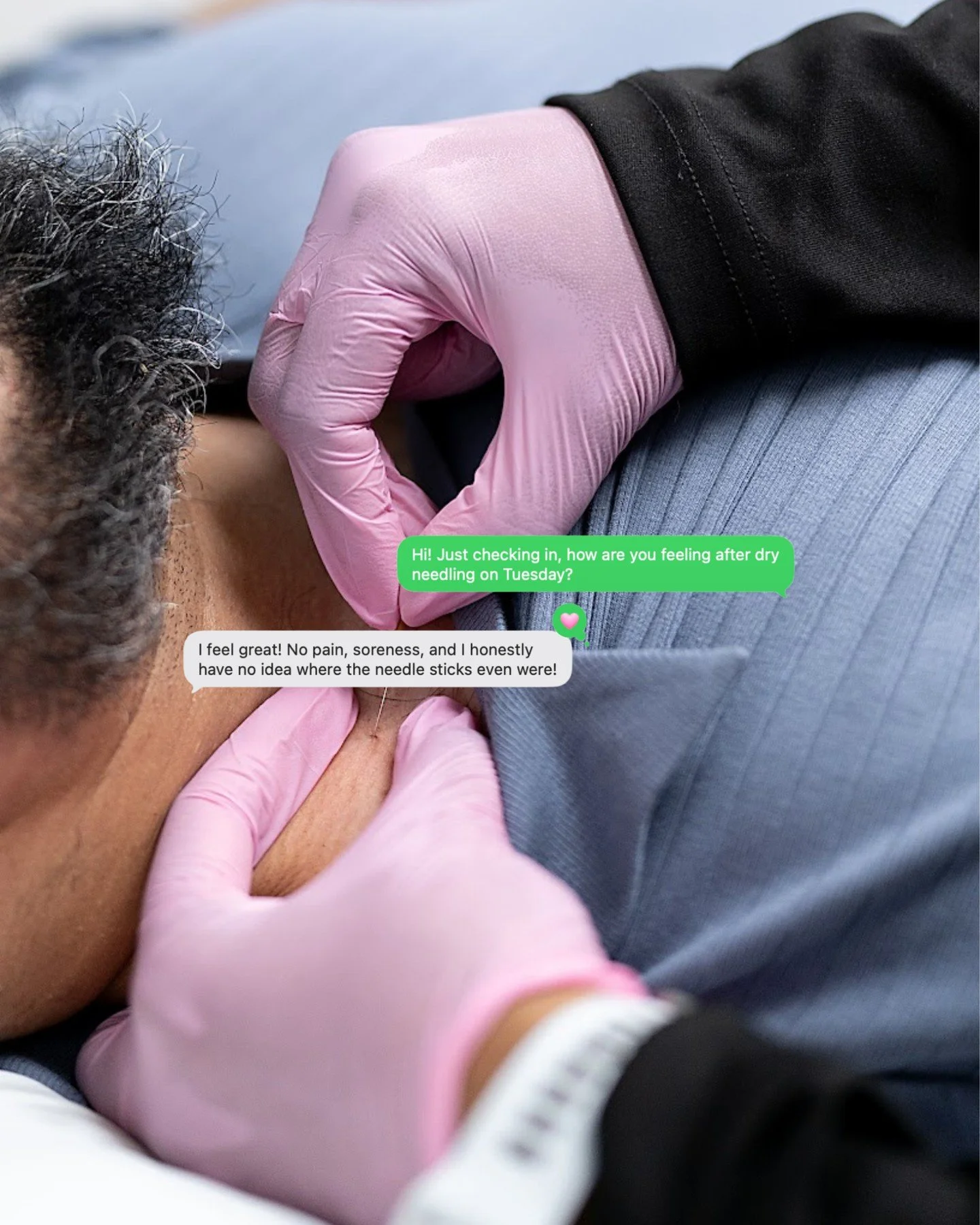 Dry Needling vs. Acupuncture

They're super similar. I'm going to talk about it from a physical therapy lens - I am certified in dry needling, not acupuncture. 

They use the same or similar needles (hollow - nothing being injected into the body, thu