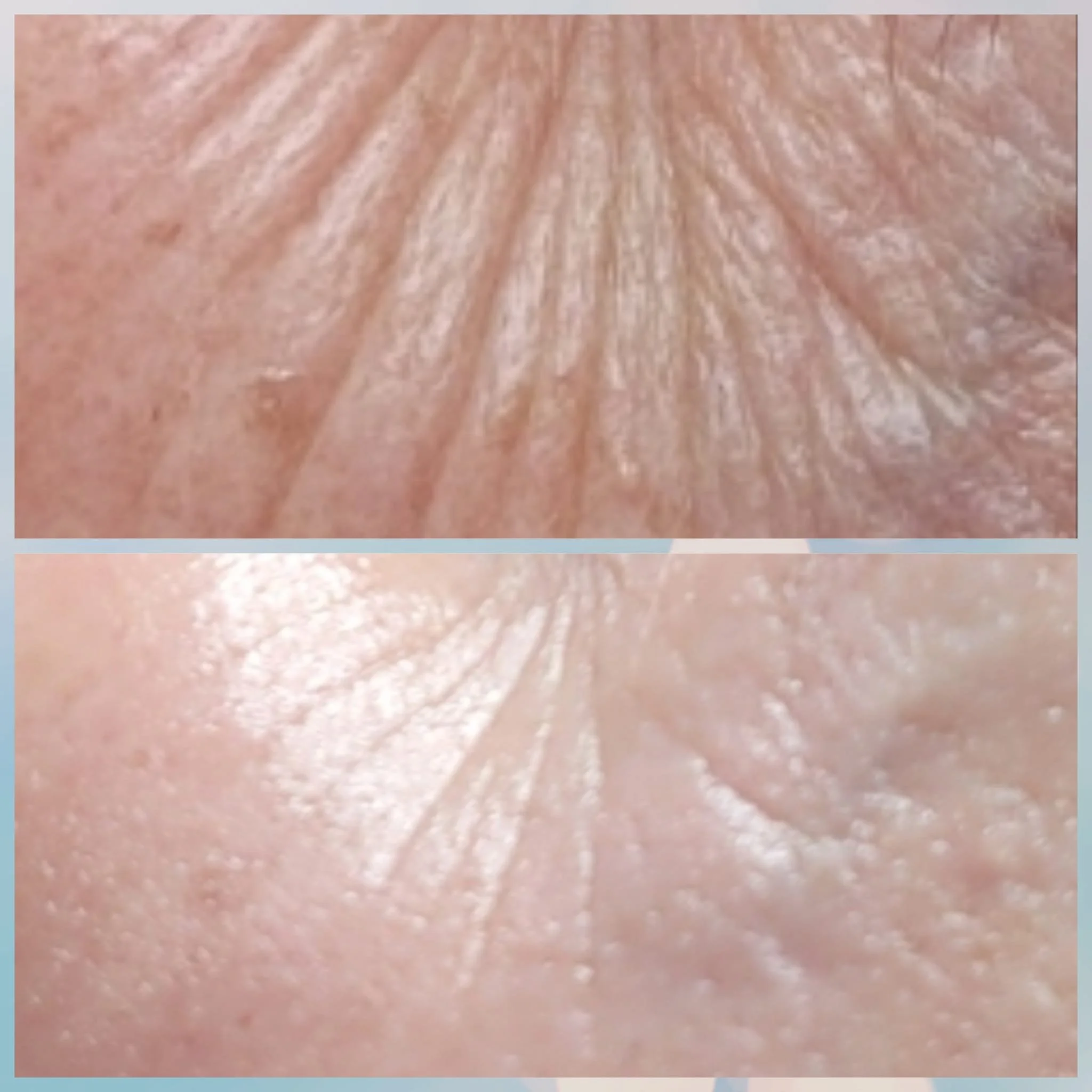 Close-up comparison of a person's skin, showing different textures and levels of dryness or moisture.