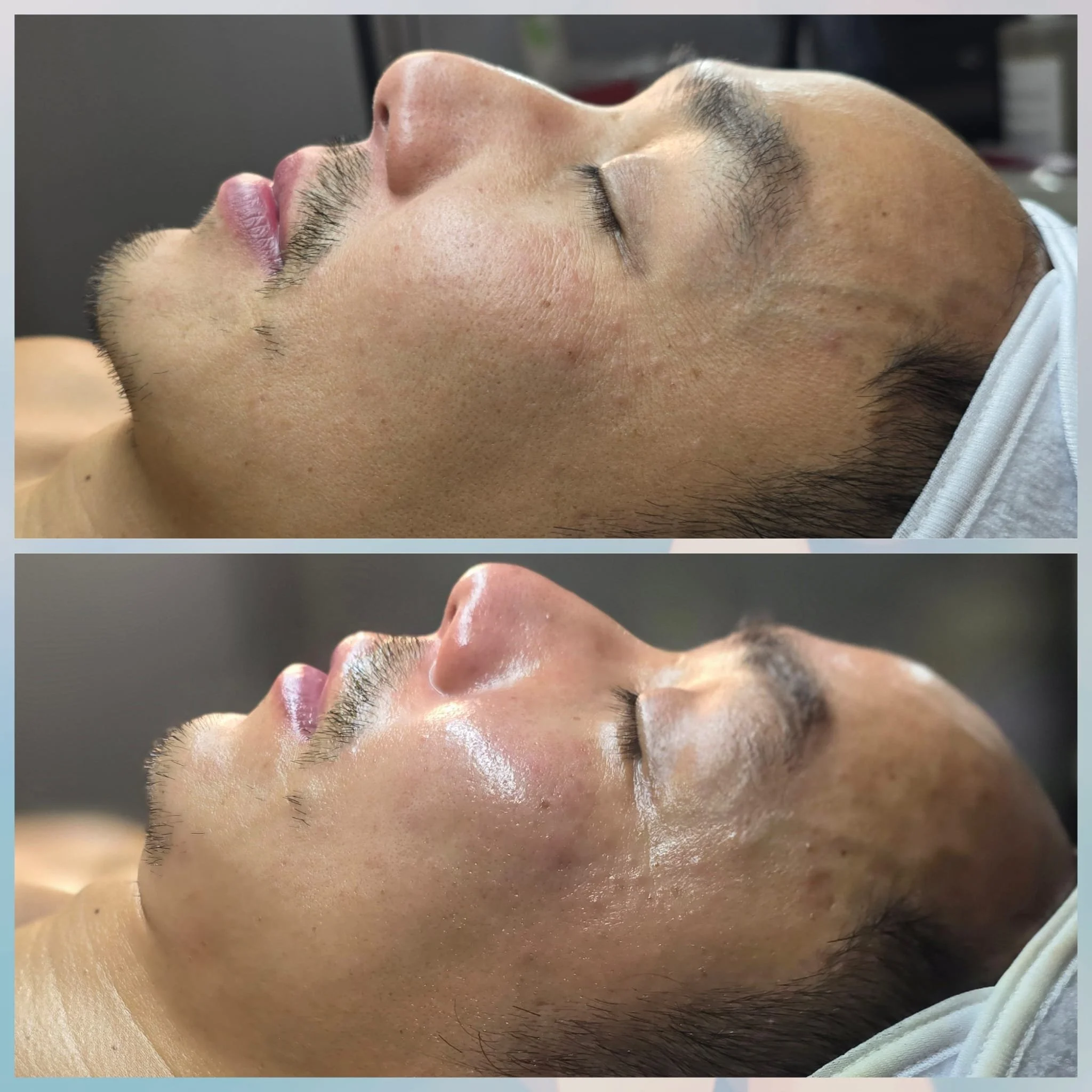 Side-by-side comparison of a man's face before and after a skincare treatment, showing smoother and more radiant skin in the after image.