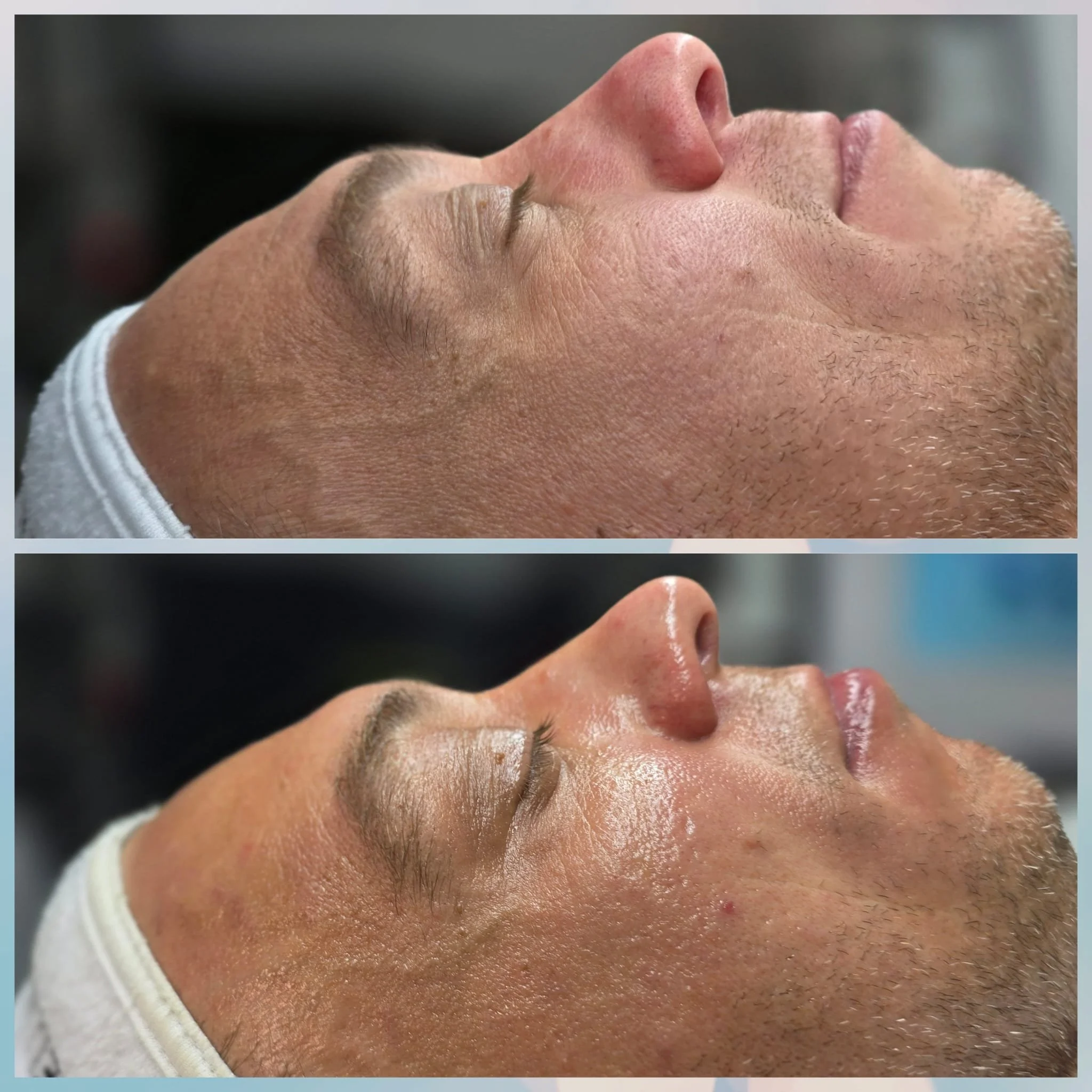Side-by-side comparison of a man's face before and after a skincare treatment, showing smoother, more radiant skin in the after image.