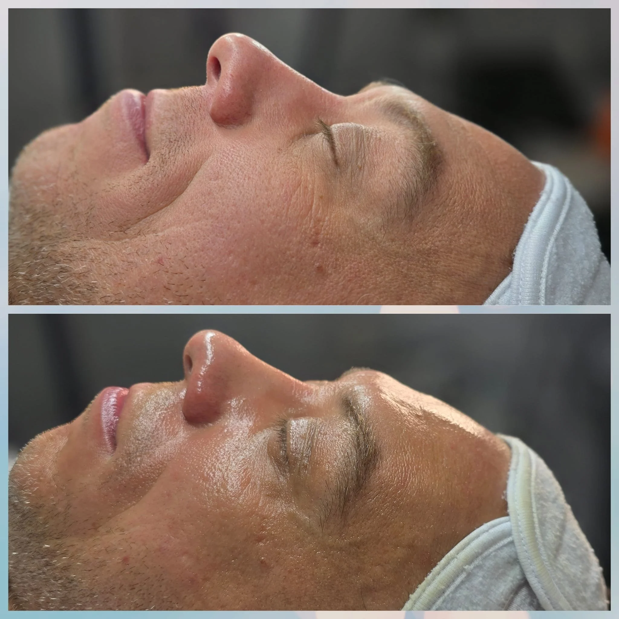 Close-up side view of a man's face before and after applying a skincare treatment, with his eyes closed and wearing a white headband.