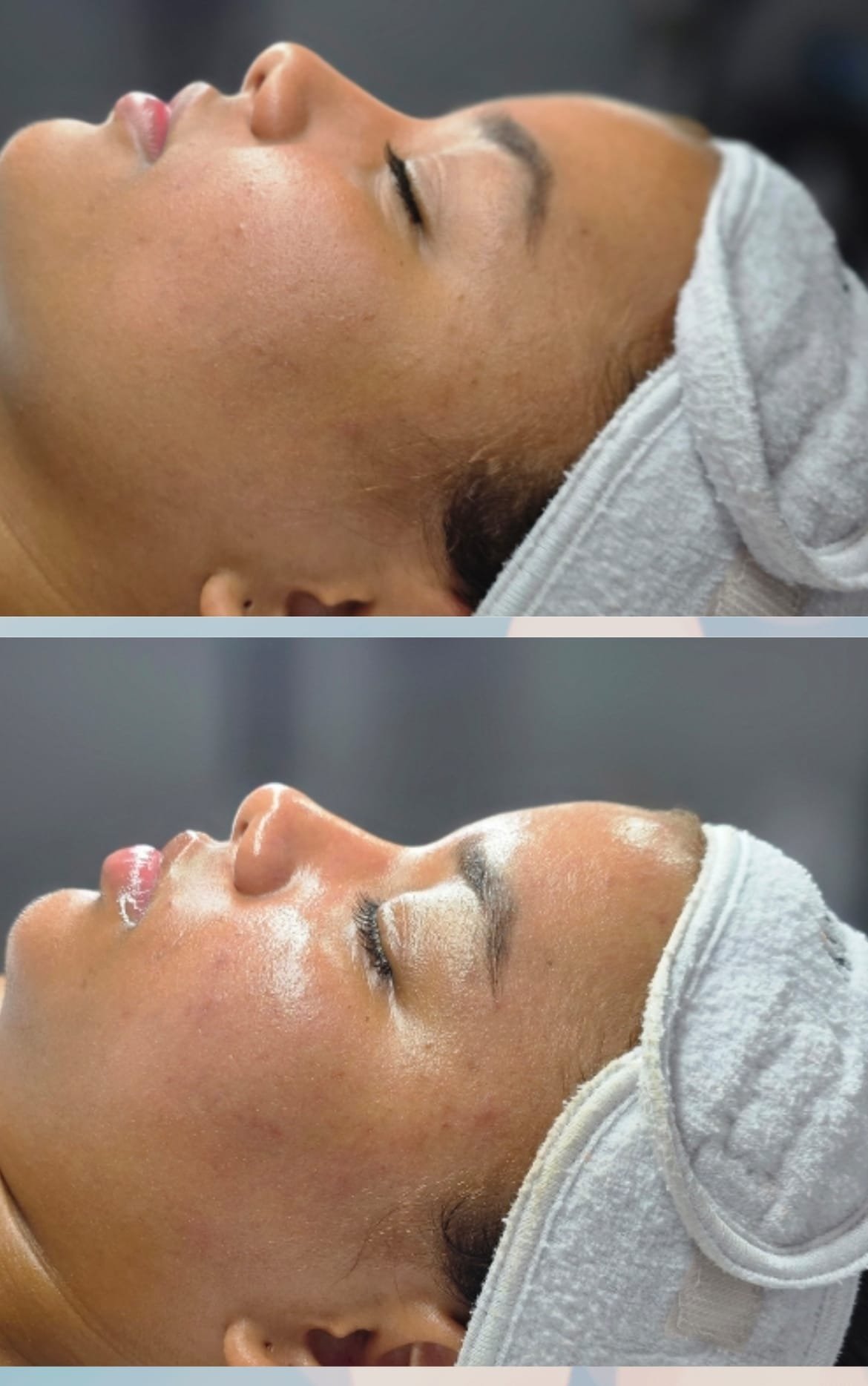 Side-by-side comparison of a woman's face before and after applying a skincare treatment or product, with a white facial mask or cream in the second image.