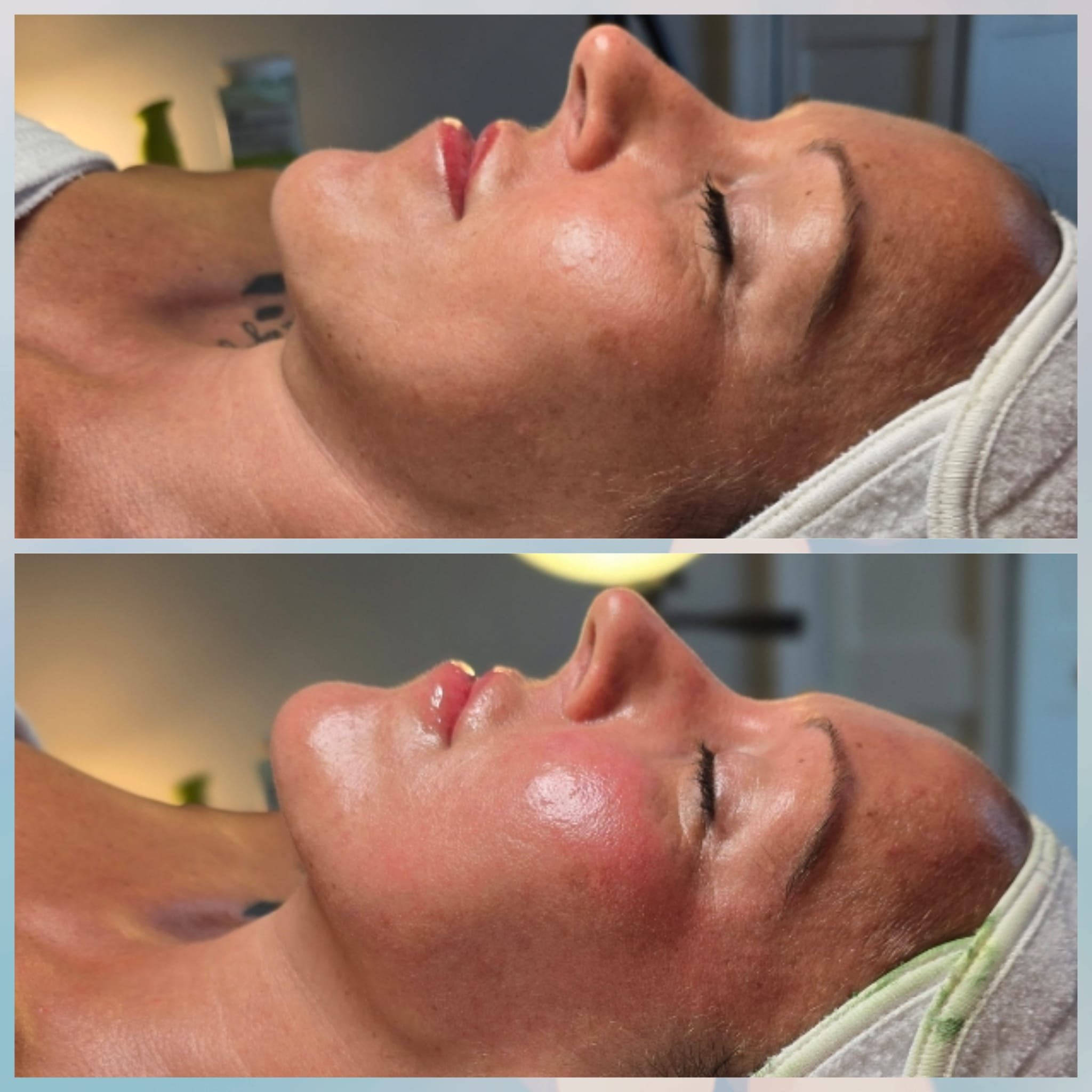 Side-by-side comparison of a woman receiving a facial treatment, showing her face before and after skincare, with her eyes closed and facial skin appearing more refreshed and glowing in the after photo.