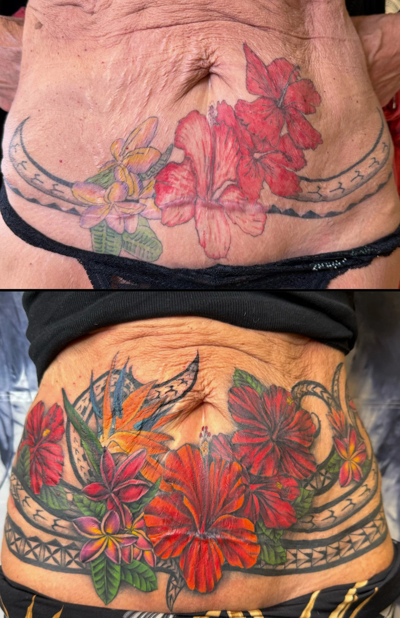 Scar Cover-Up Tattoo: Transforming a Tummy Tuck Scar