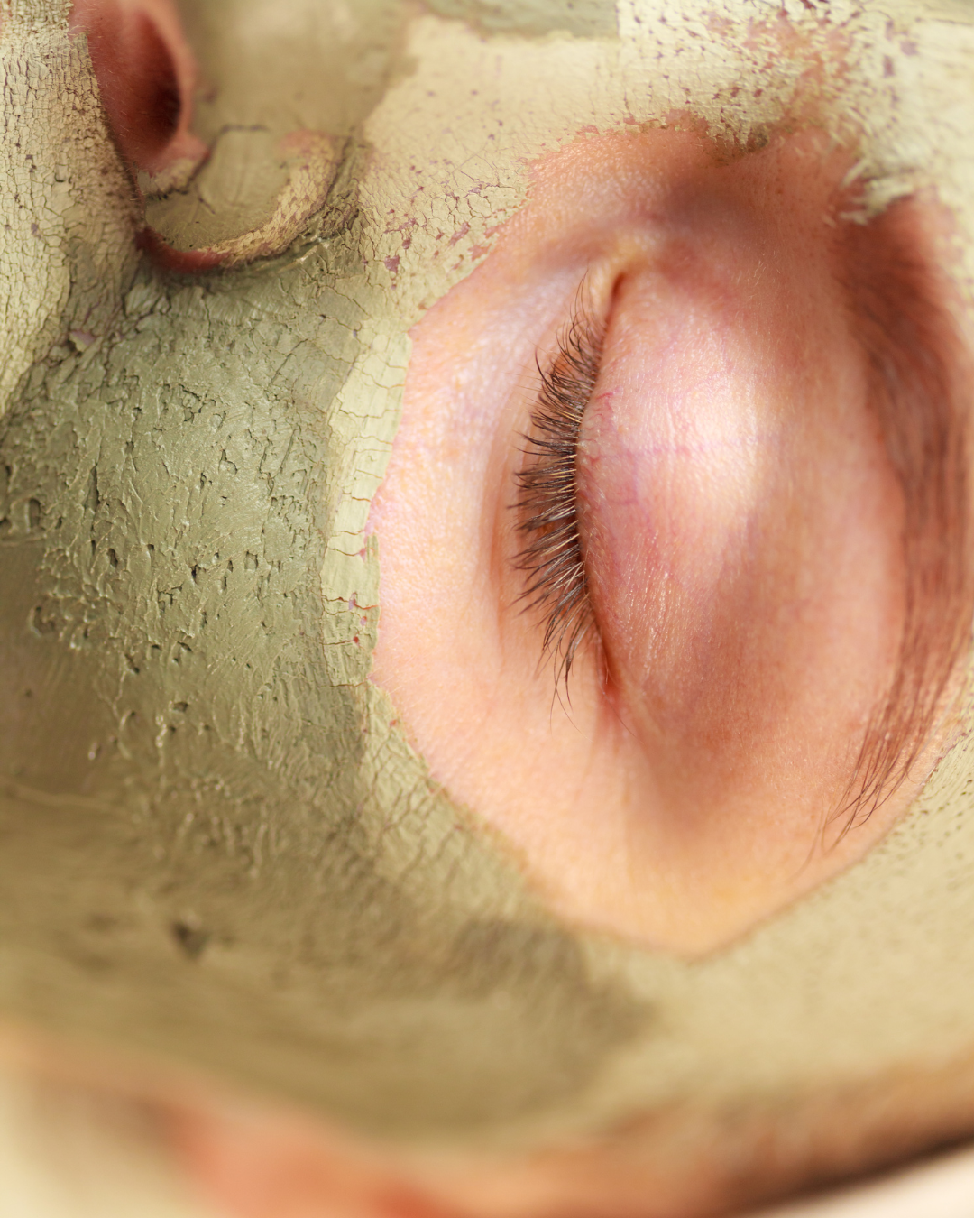 Una paciente en Studio Maite Alvarez con la aplicación de una mascarilla facial, durante una sesión de cosmetología médica.