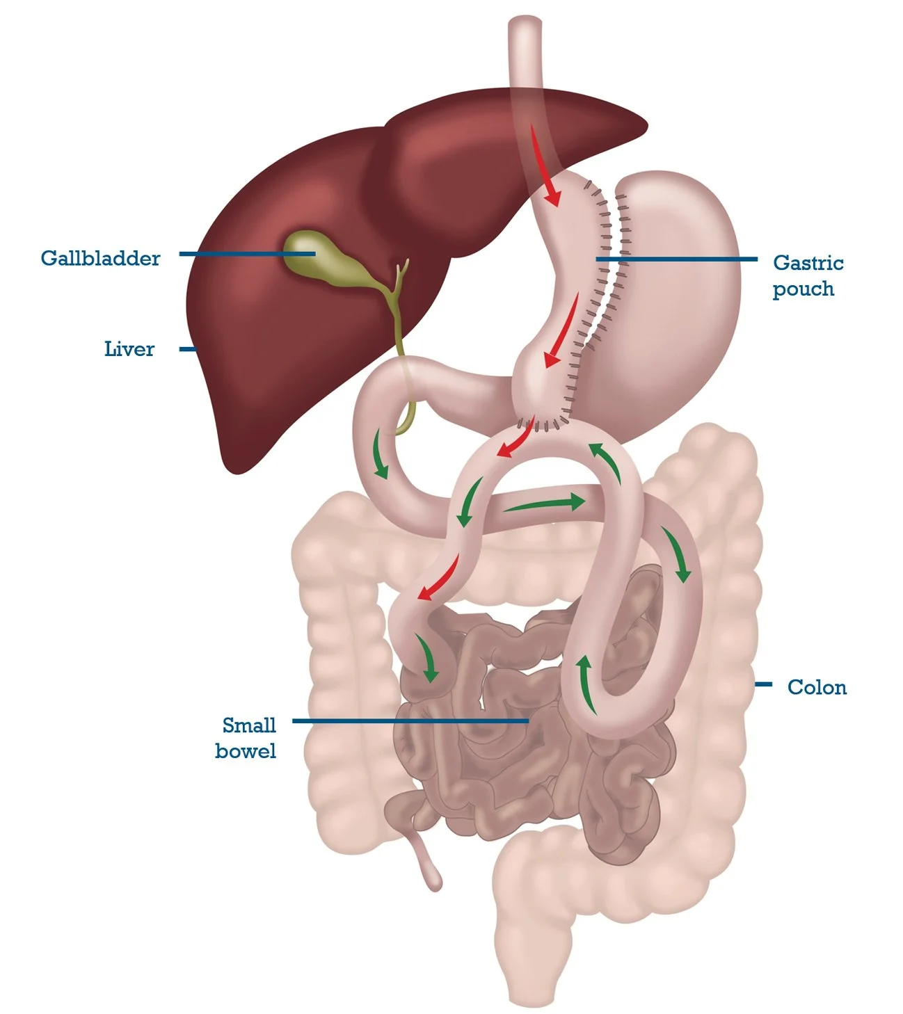 Diagram showing the path of digestion from the stomach to the small bowel and colon, including the gallbladder, liver, gastric pouch, and arrows indicating flow direction.