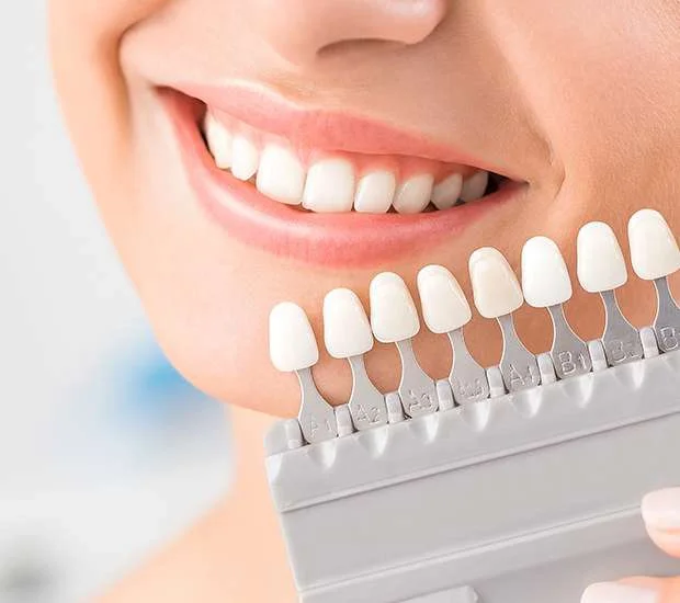 Advanced Digital Smile_No-Prep Veneers photo