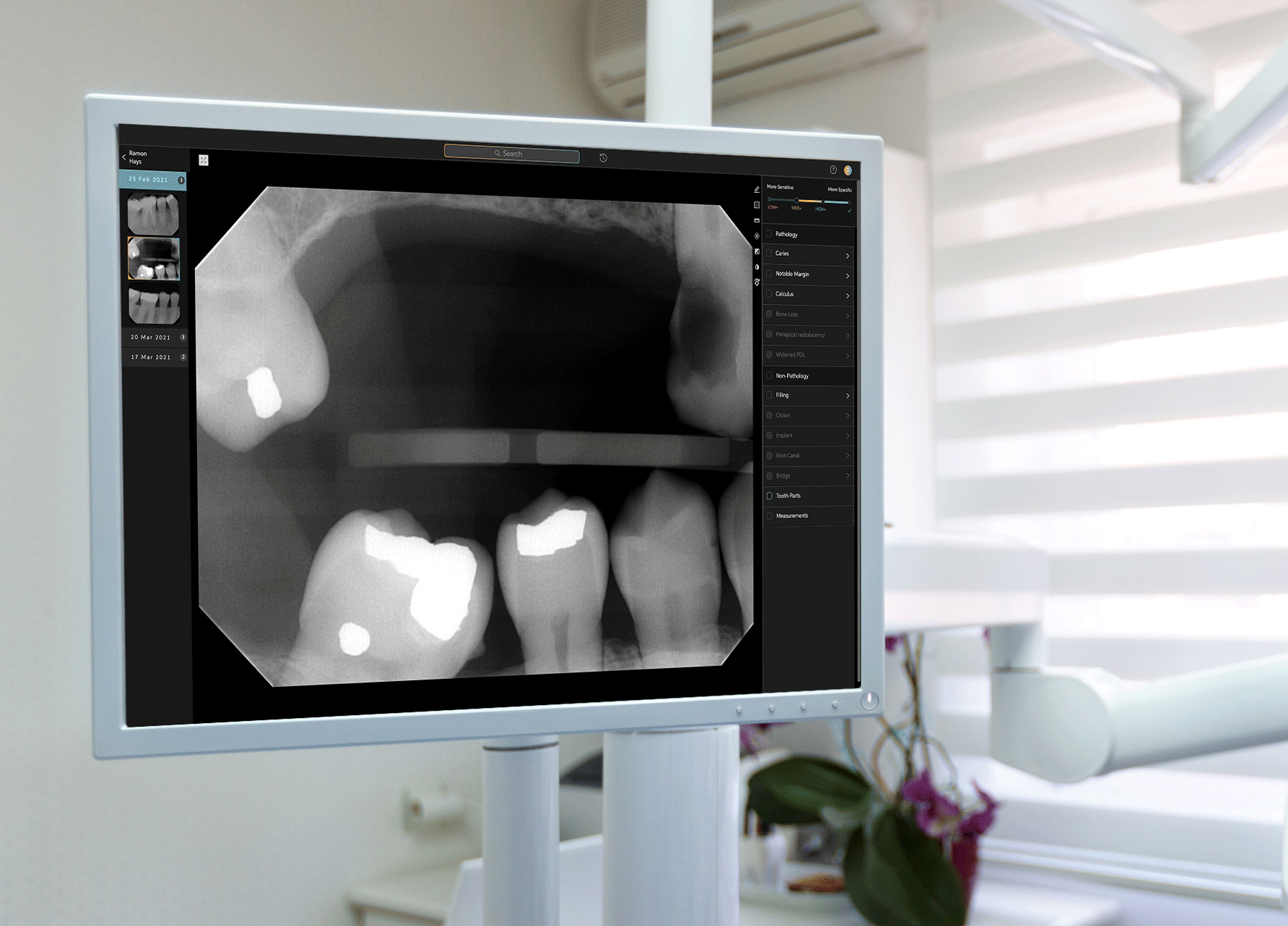 AI-Powered Second Opinions_Advanced Dental Technology photo