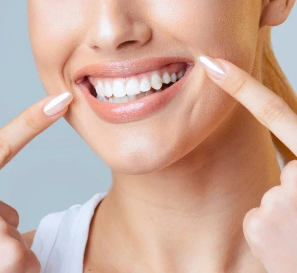 Long-Term Smile Enhancement_No-Prep Veneers photo