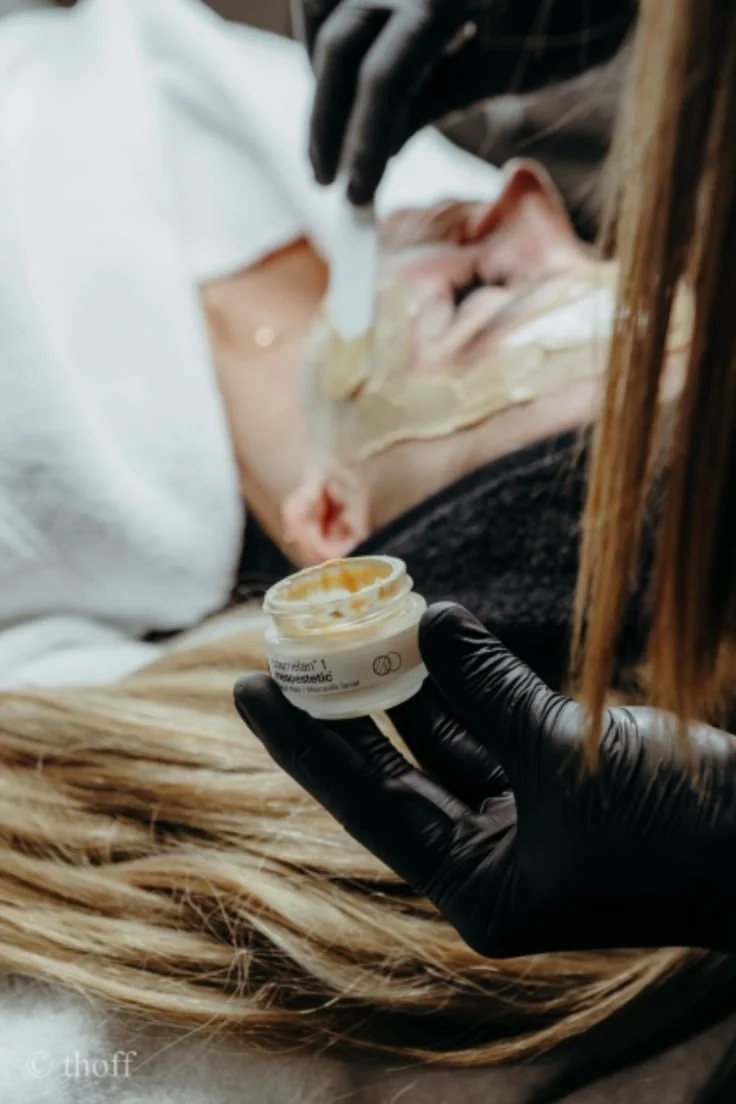 Melasma: Why Microneedling Might Beat Cosmelan and Dermamelan Peel