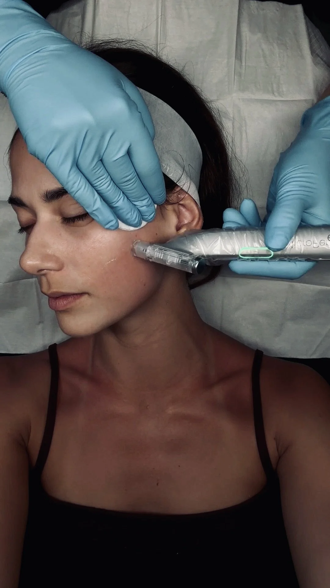 Skin Needling, Microneedling, Collagen