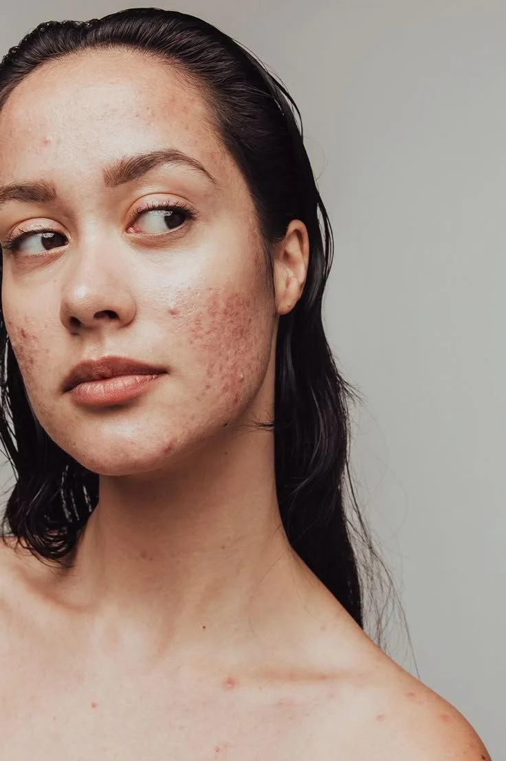 ReSet & ReBuild Program